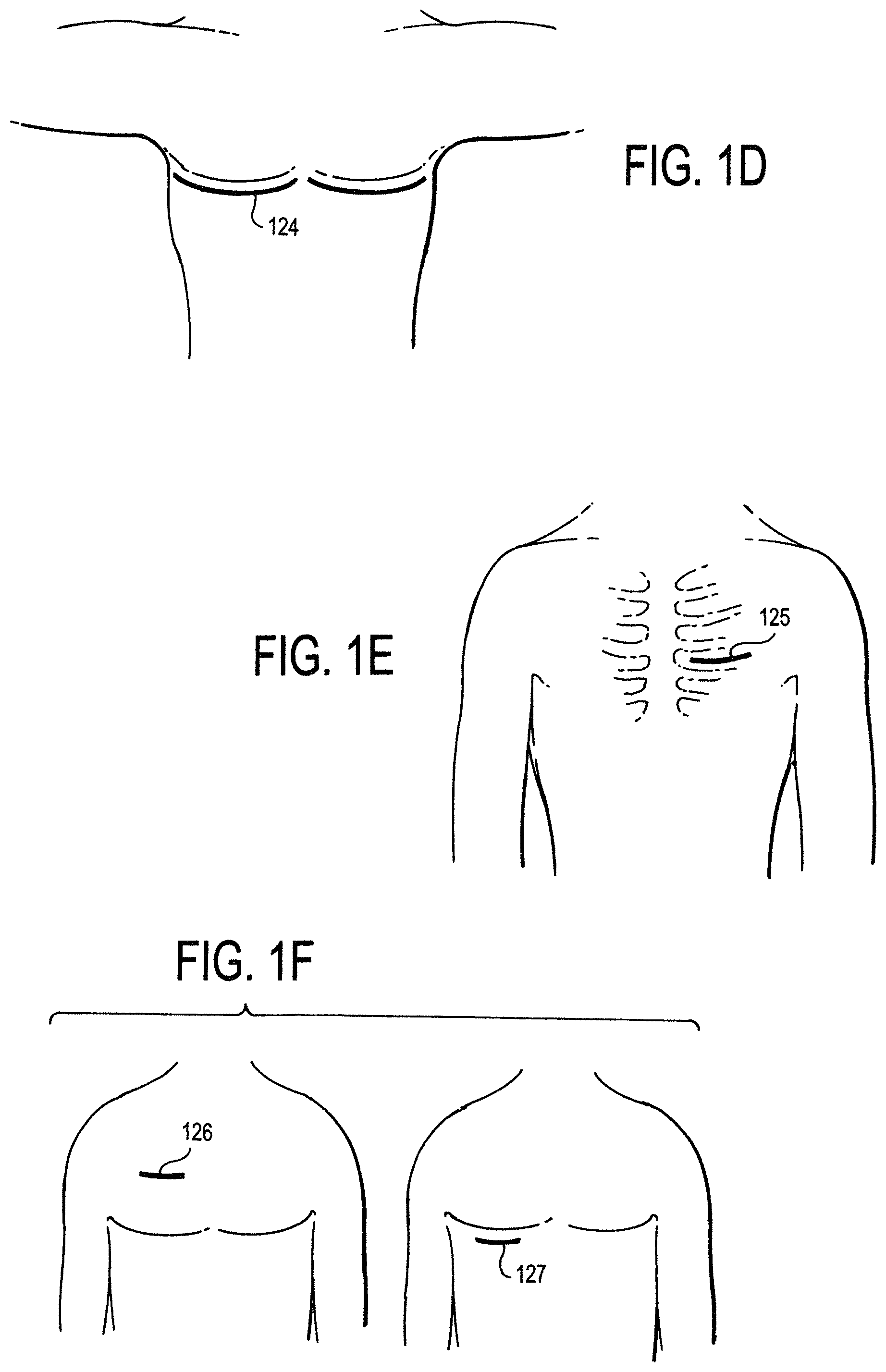 Patent US11771887 Figure 2 – Configurable electrodes and sensors