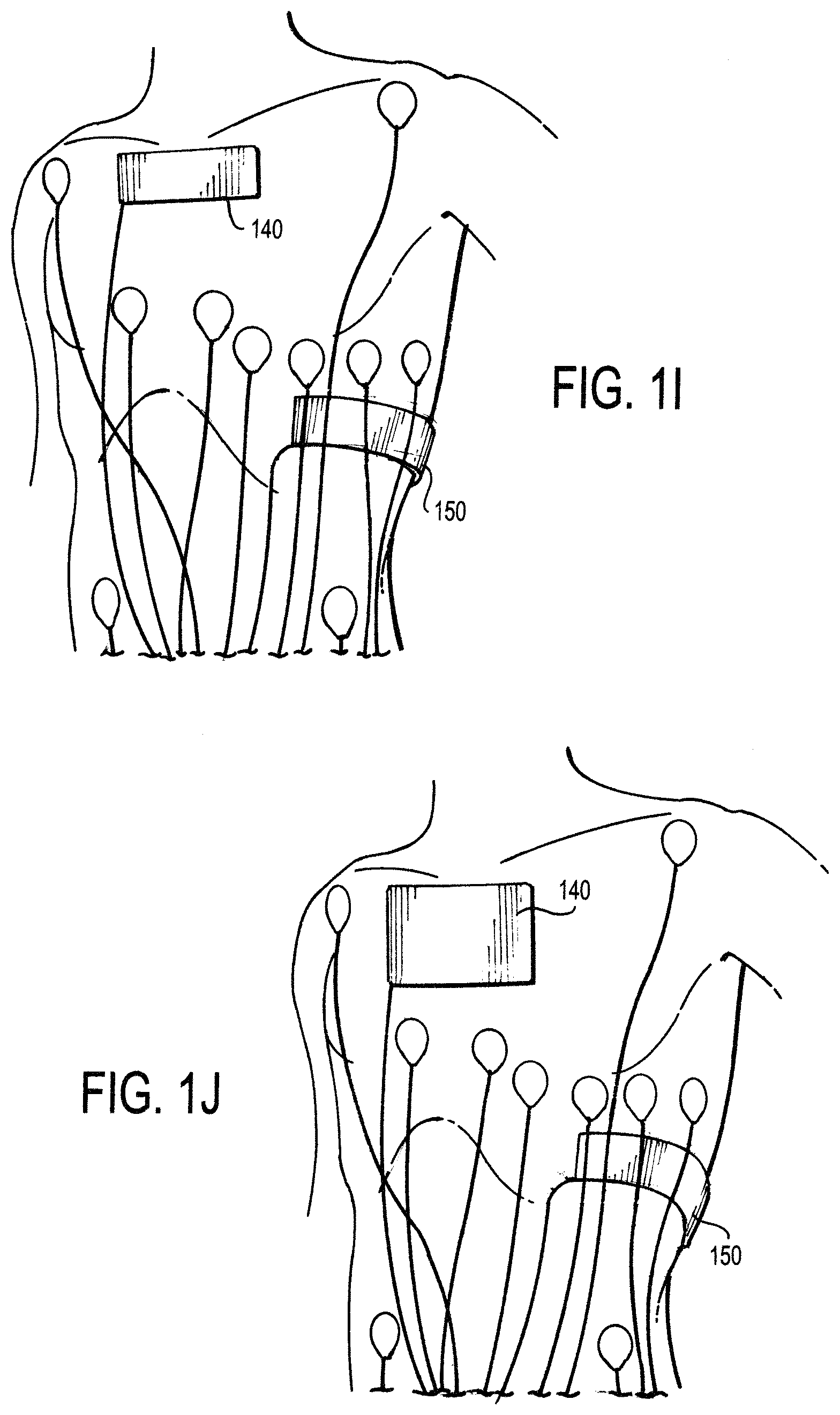 Patent US11771887 Figure 4 – Configurable electrodes and sensors