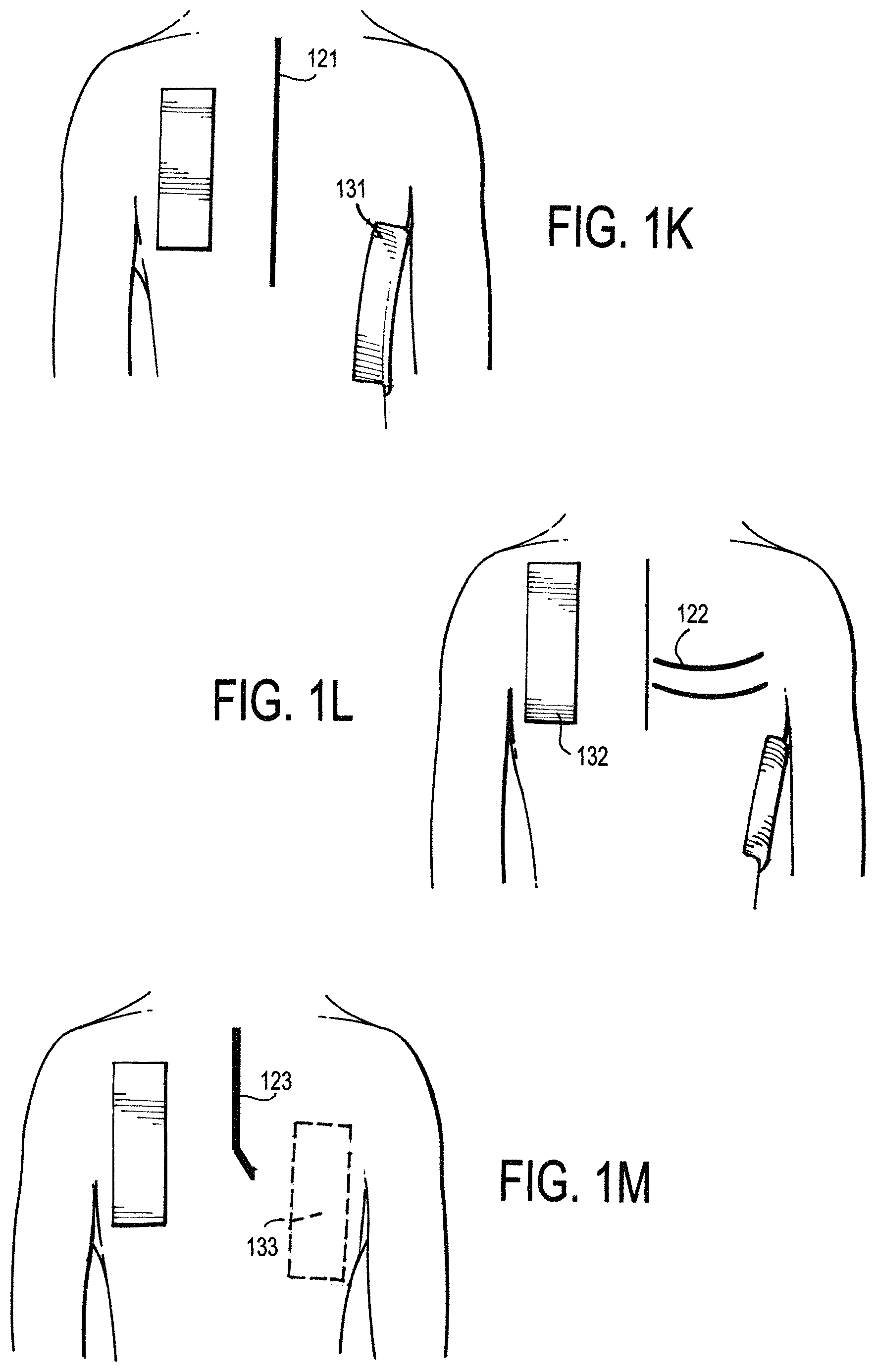 Patent US11771887 Figure 5 – Configurable electrodes and sensors