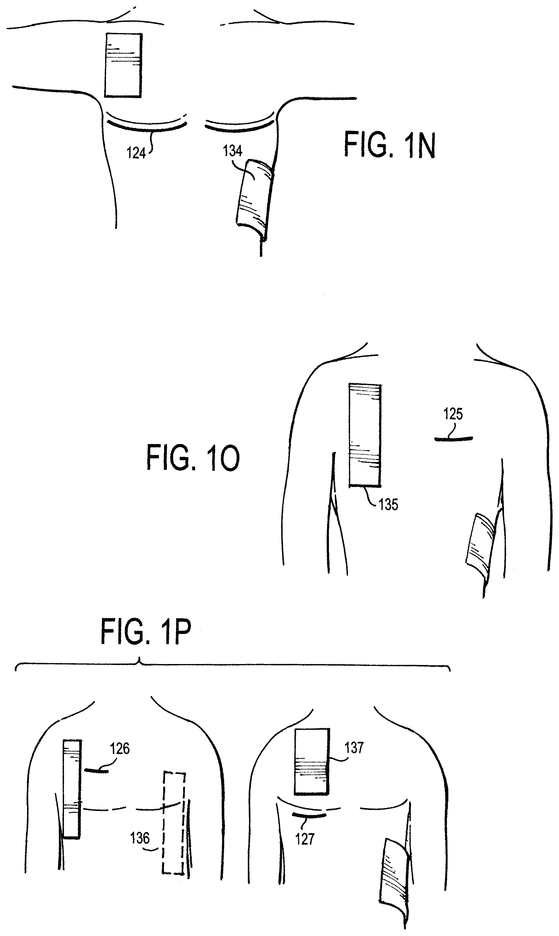Patent US11771887 Figure 6 – Configurable electrodes and sensors