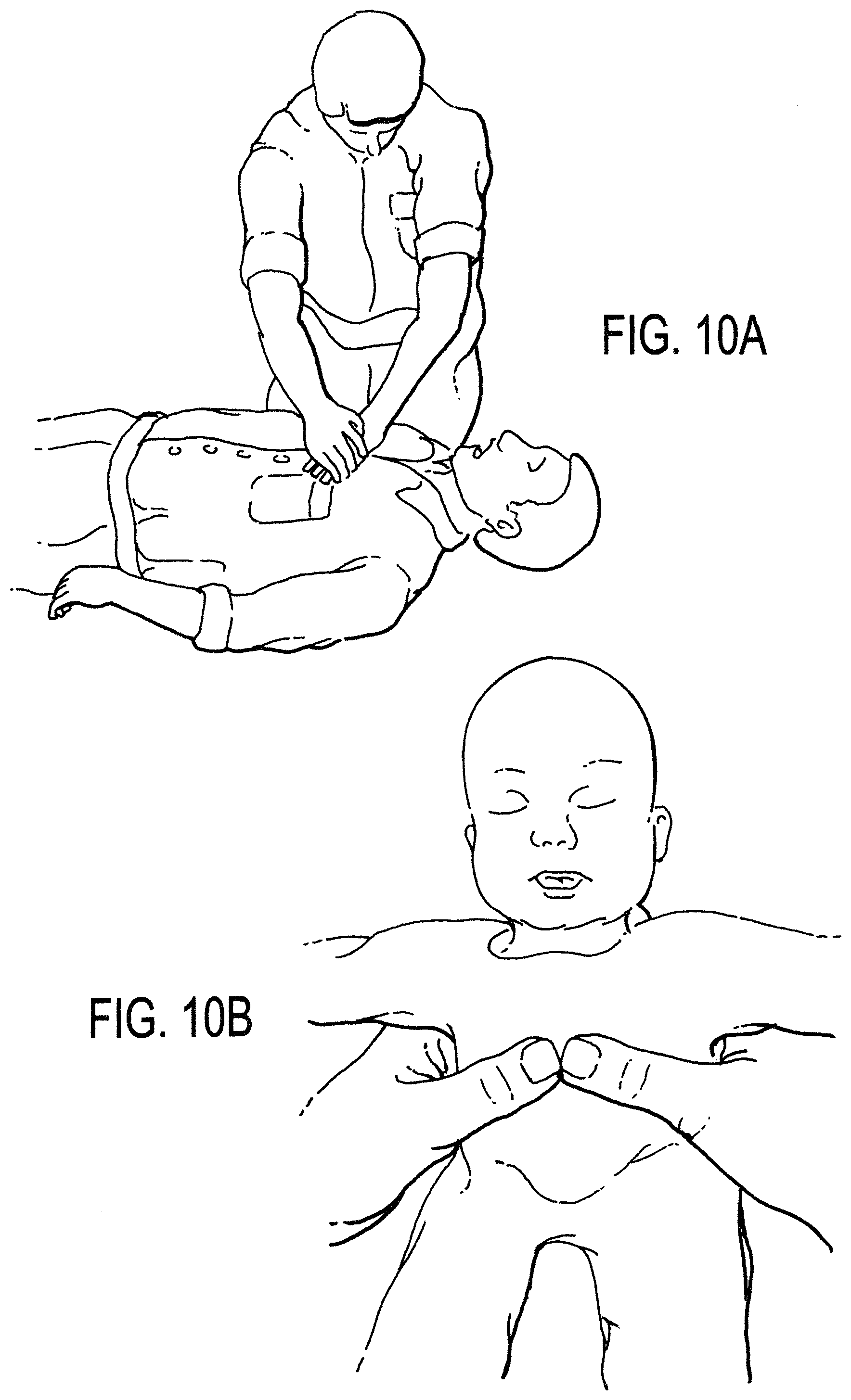 Patent US11771887 Figure 15 – Configurable electrodes and sensors