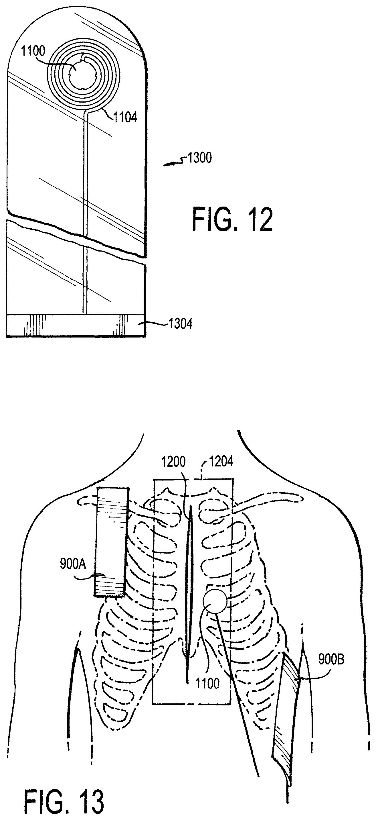 Patent US11771887 Figure 17 – Configurable electrodes and sensors