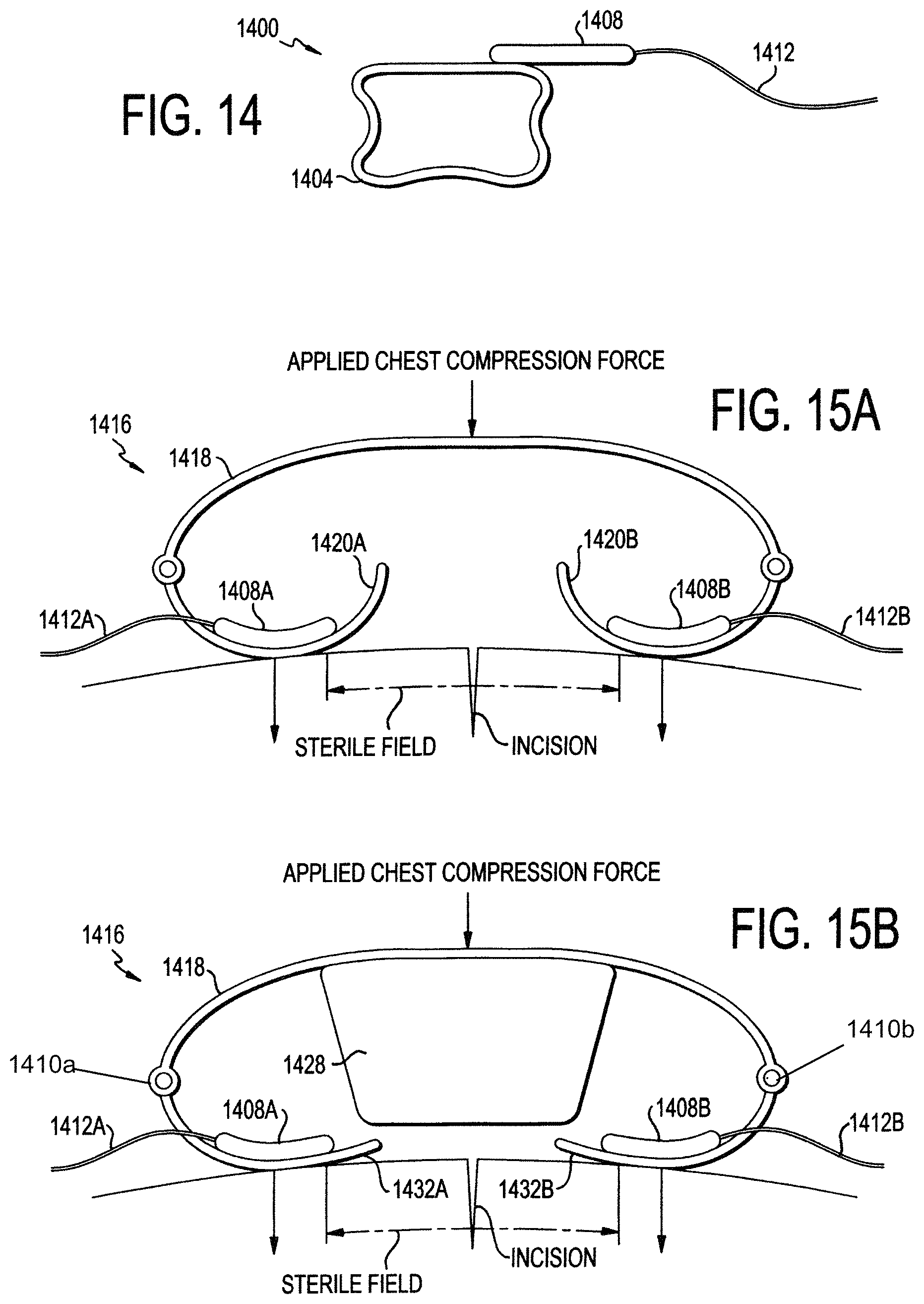 Patent US11771887 Figure 18 – Configurable electrodes and sensors