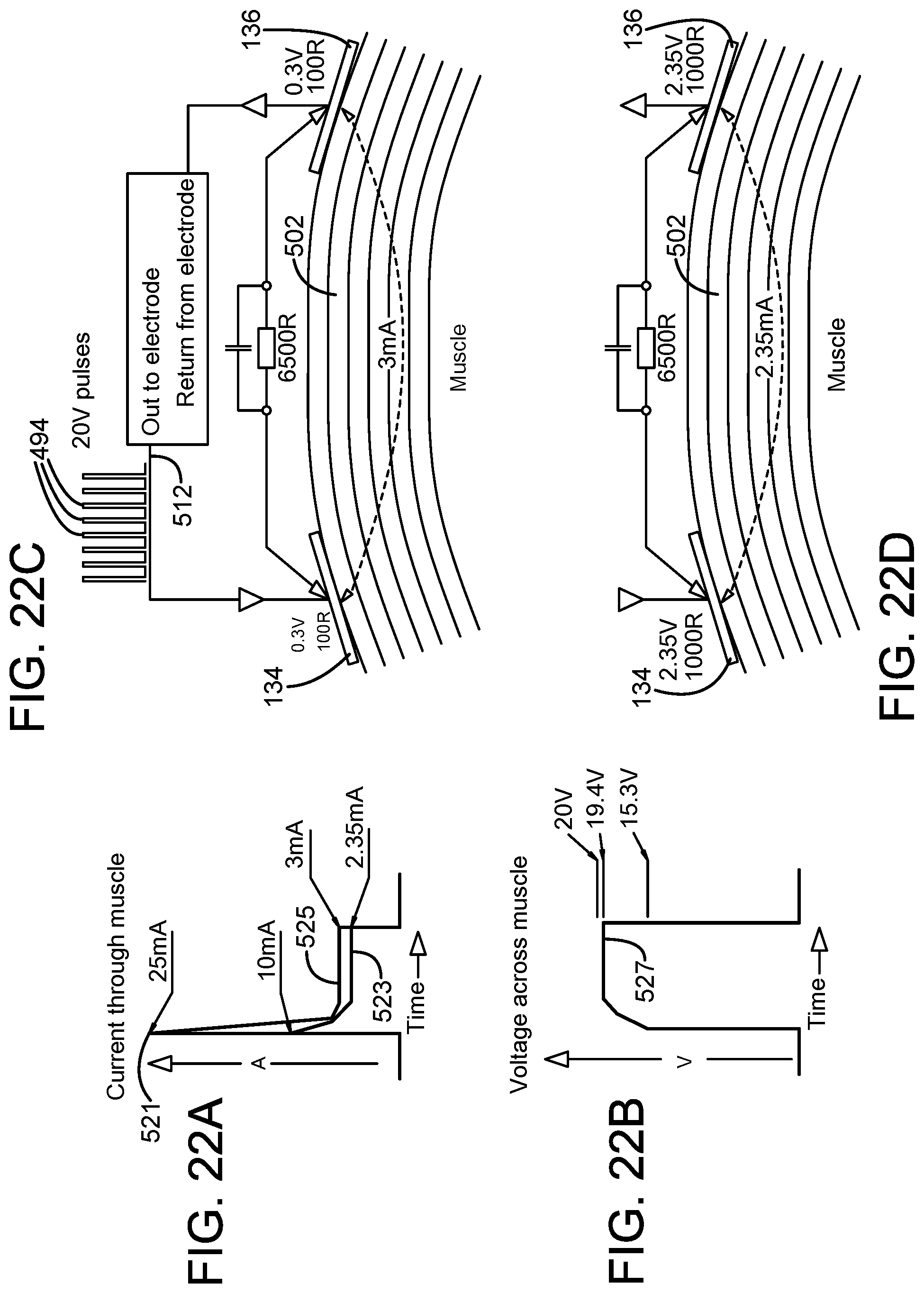 Patent US11771888 Figure 17 – Medical therapy arrangement for applying an electrical stimulation to a human or animal subject