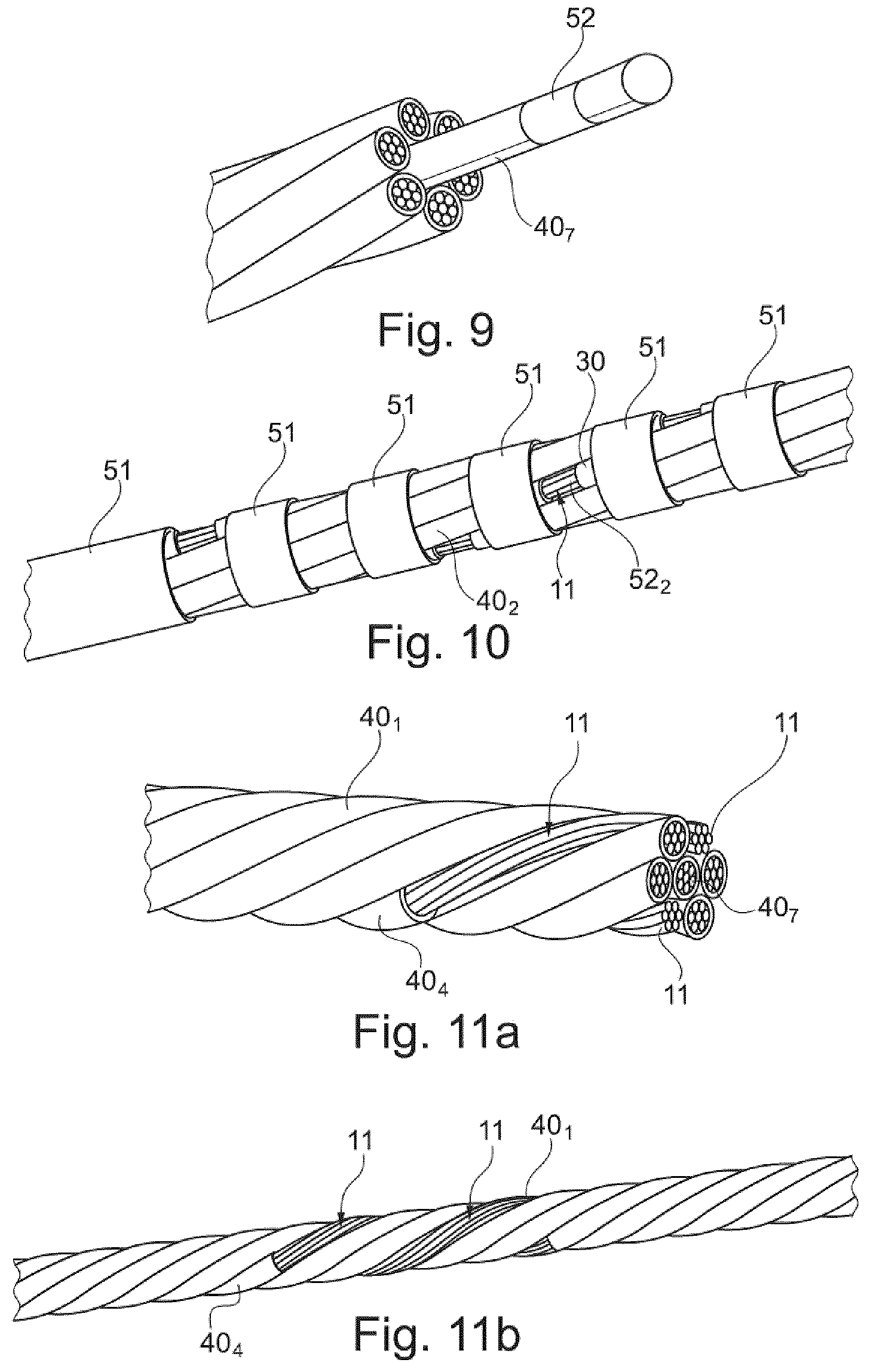 Patent US11771889 Figure 4 – Implantable detection/stimulation multipolor microlead