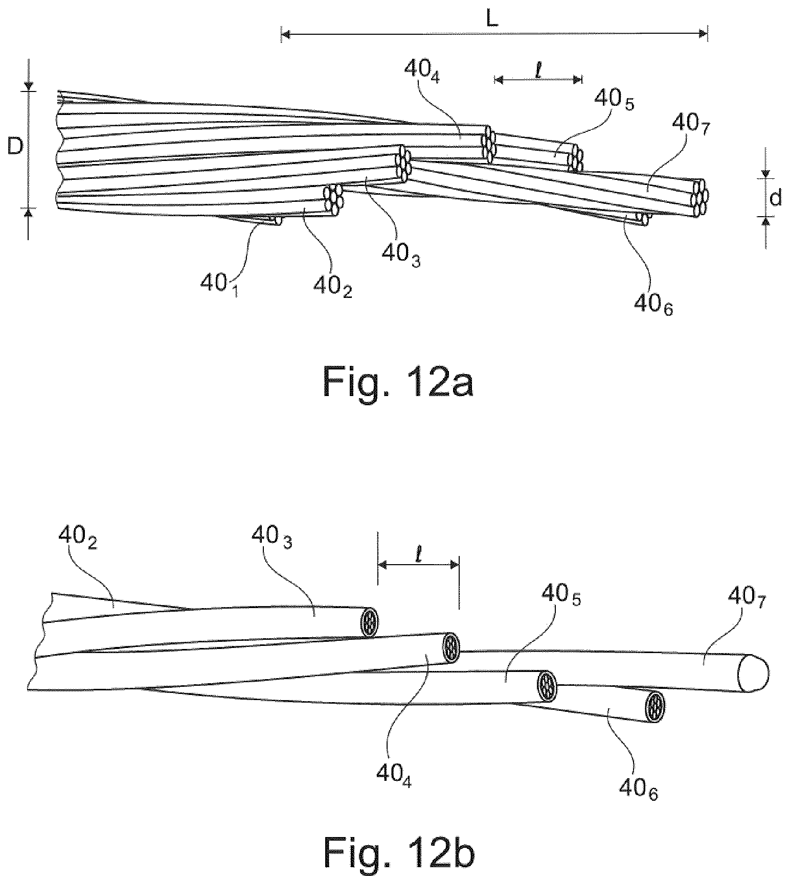 Patent US11771889 Figure 5 – Implantable detection/stimulation multipolor microlead