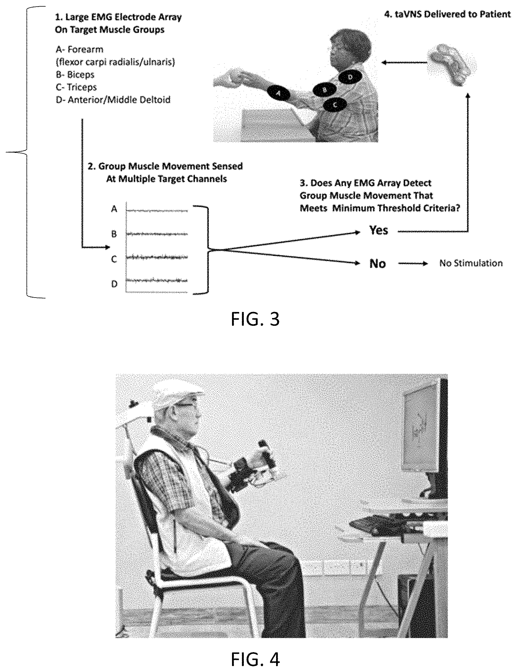 Patent US11771893 Figure 3 – Motion-activated, closed-loop non-invasive vagus nerve stimulation for neurorehabtlitation