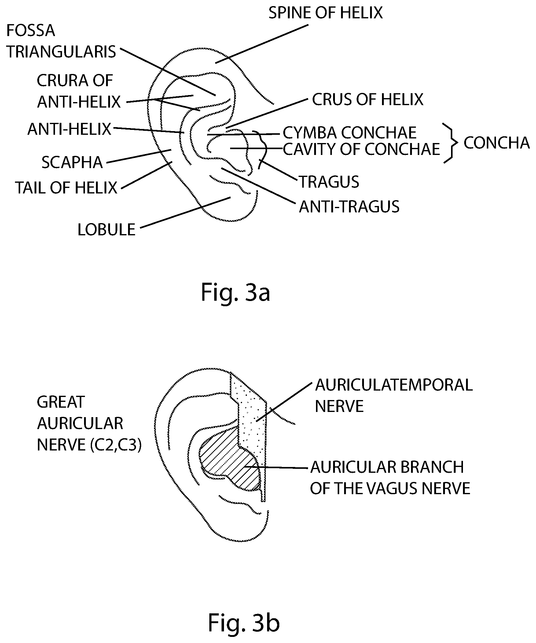 Patent US11771895 Figure 3 – Compact auricular stimulation device