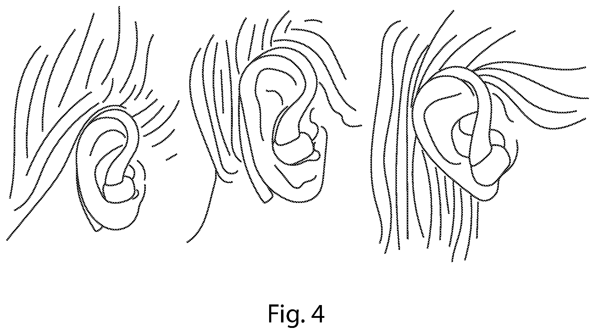 Patent US11771895 Figure 4 – Compact auricular stimulation device