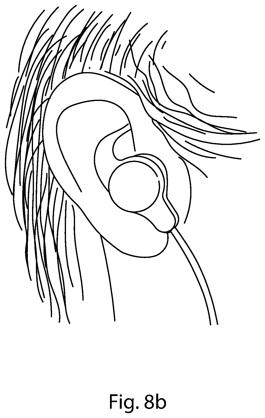 Patent US11771895 Figure 9 – Compact auricular stimulation device