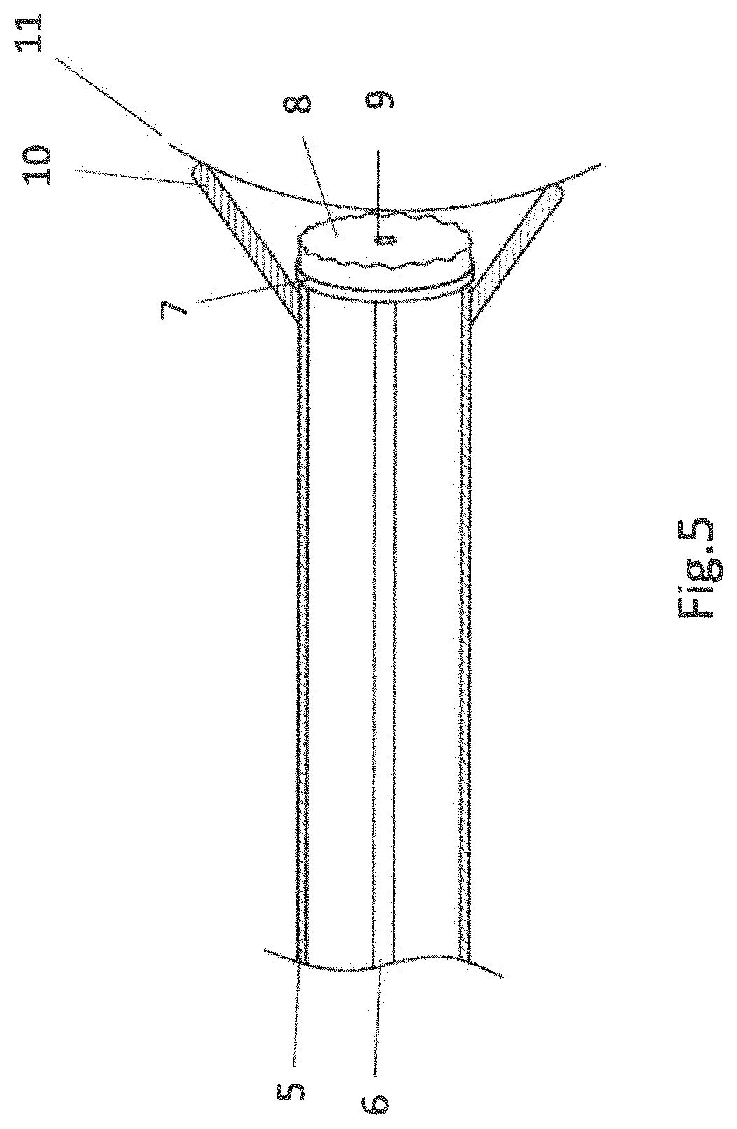 Patent US11771897 Figure 4 – System, method and catheter for pituitary and brain implantation
