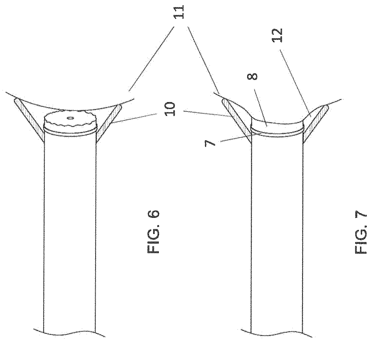 Patent US11771897 Figure 5 – System, method and catheter for pituitary and brain implantation