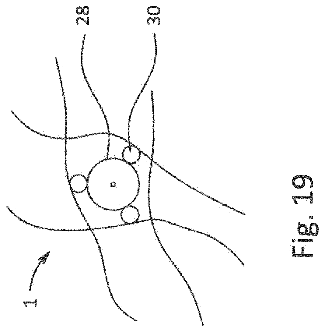 Patent US11771897 Figure 15 – System, method and catheter for pituitary and brain implantation