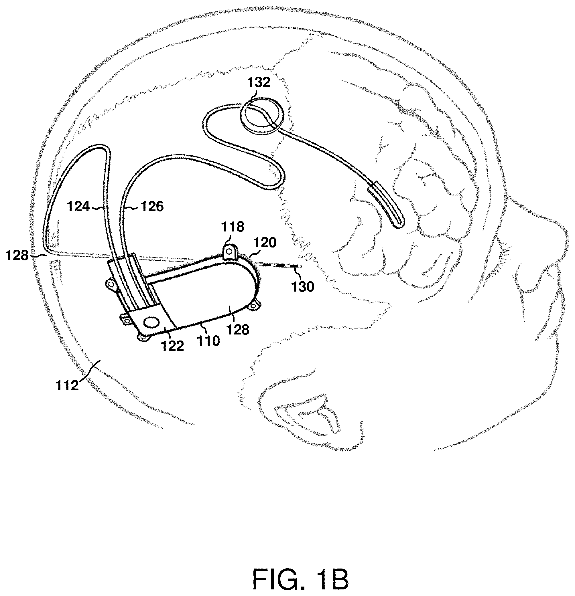 Patent US11771898 Figure 2 – Seizure onset classification and stimulation parameter selection