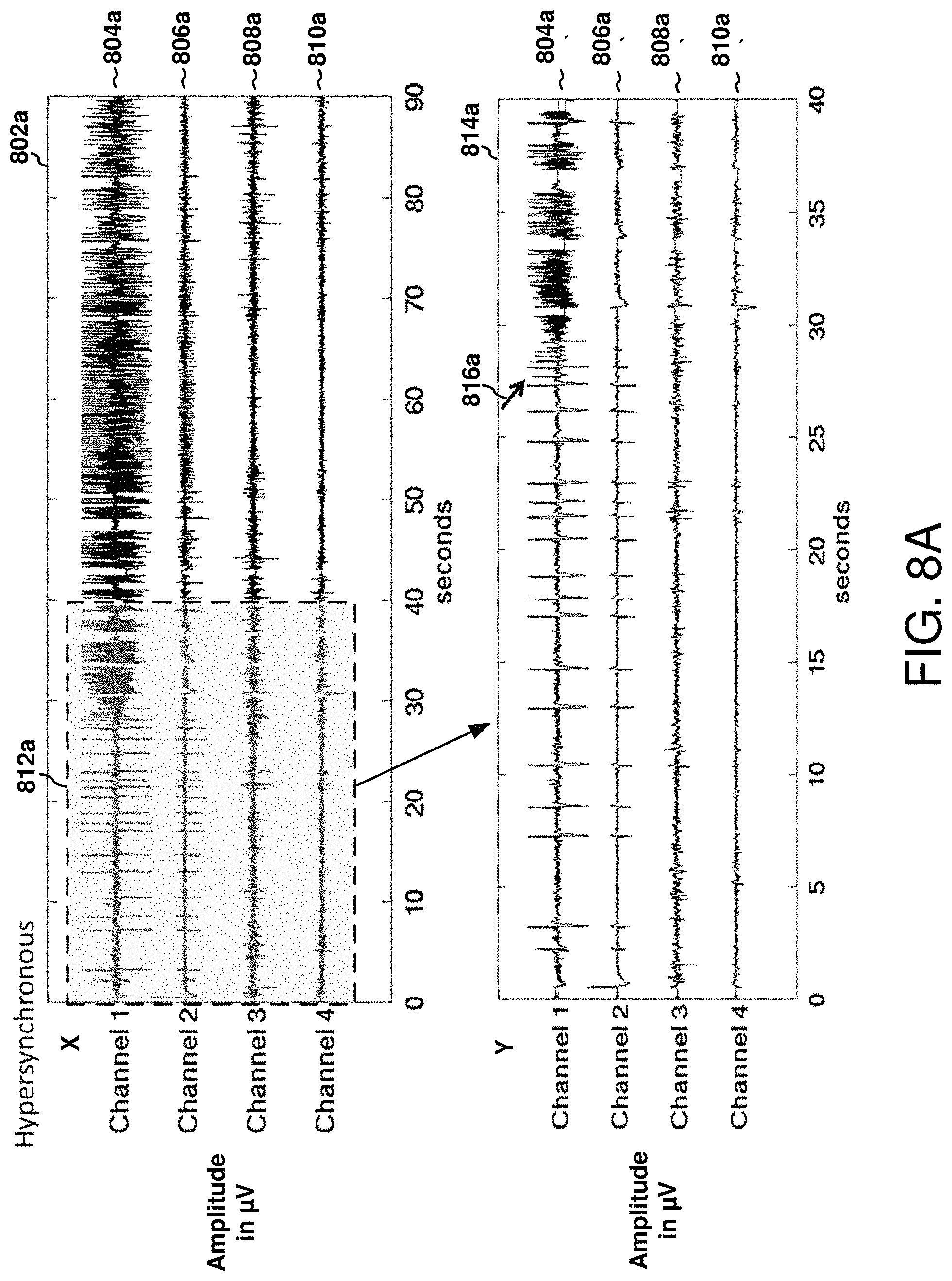 Patent US11771898 Figure 10 – Seizure onset classification and stimulation parameter selection