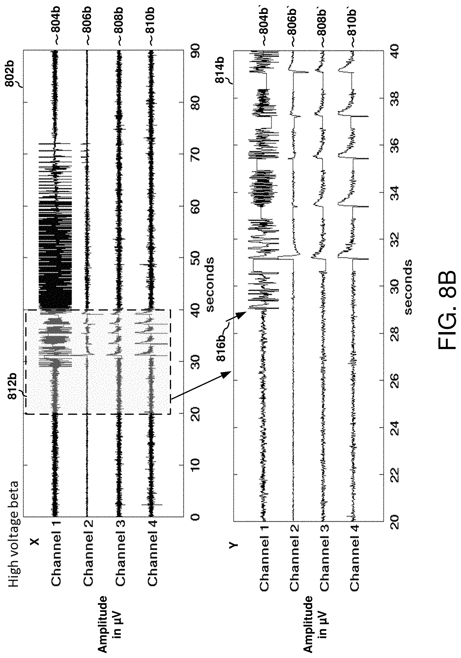 Patent US11771898 Figure 11 – Seizure onset classification and stimulation parameter selection