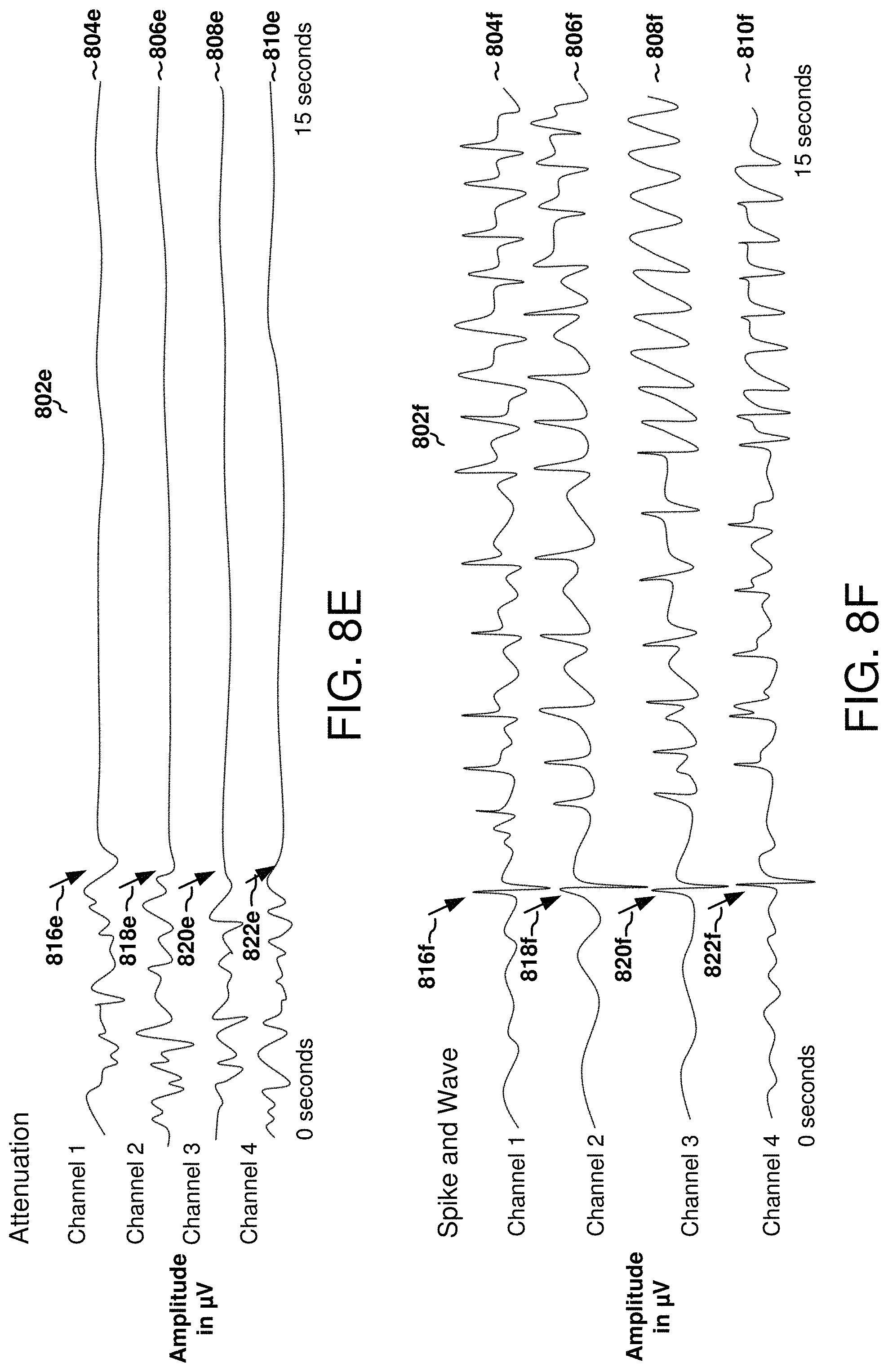 Patent US11771898 Figure 14 – Seizure onset classification and stimulation parameter selection