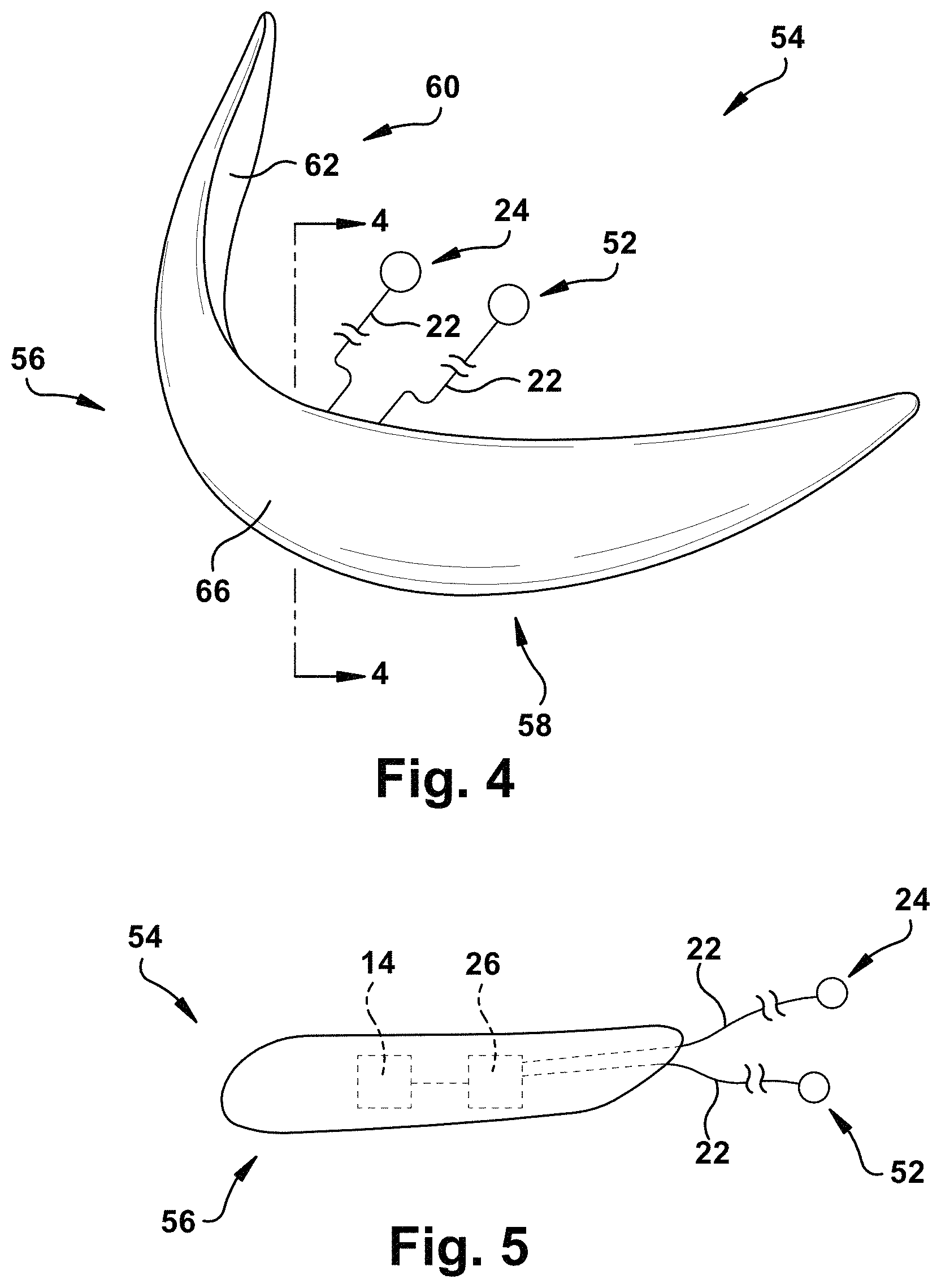 Patent US11771899 Figure 4 – System and method for treating obstructive sleep apnea