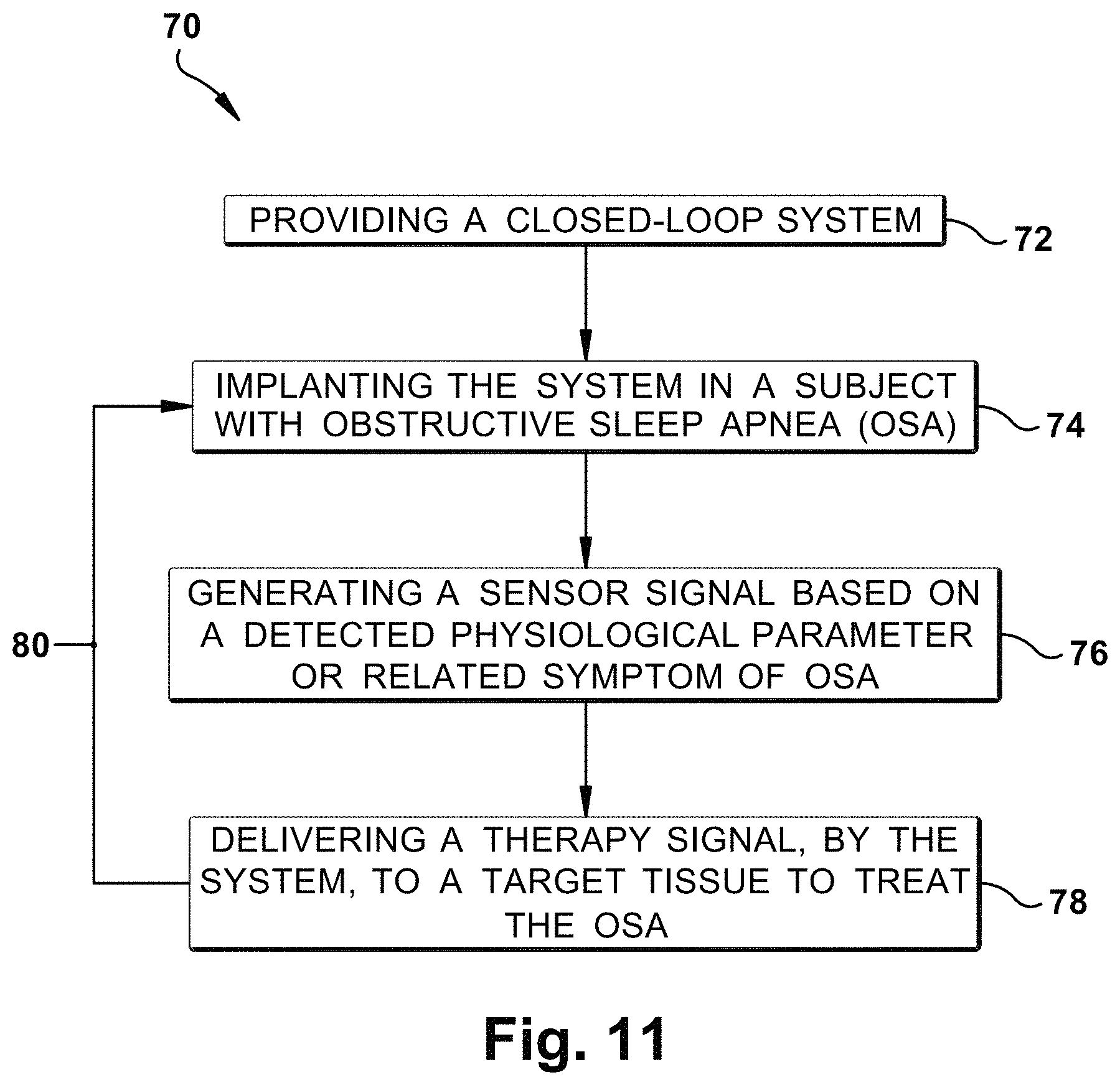 Patent US11771899 Figure 11 – System and method for treating obstructive sleep apnea