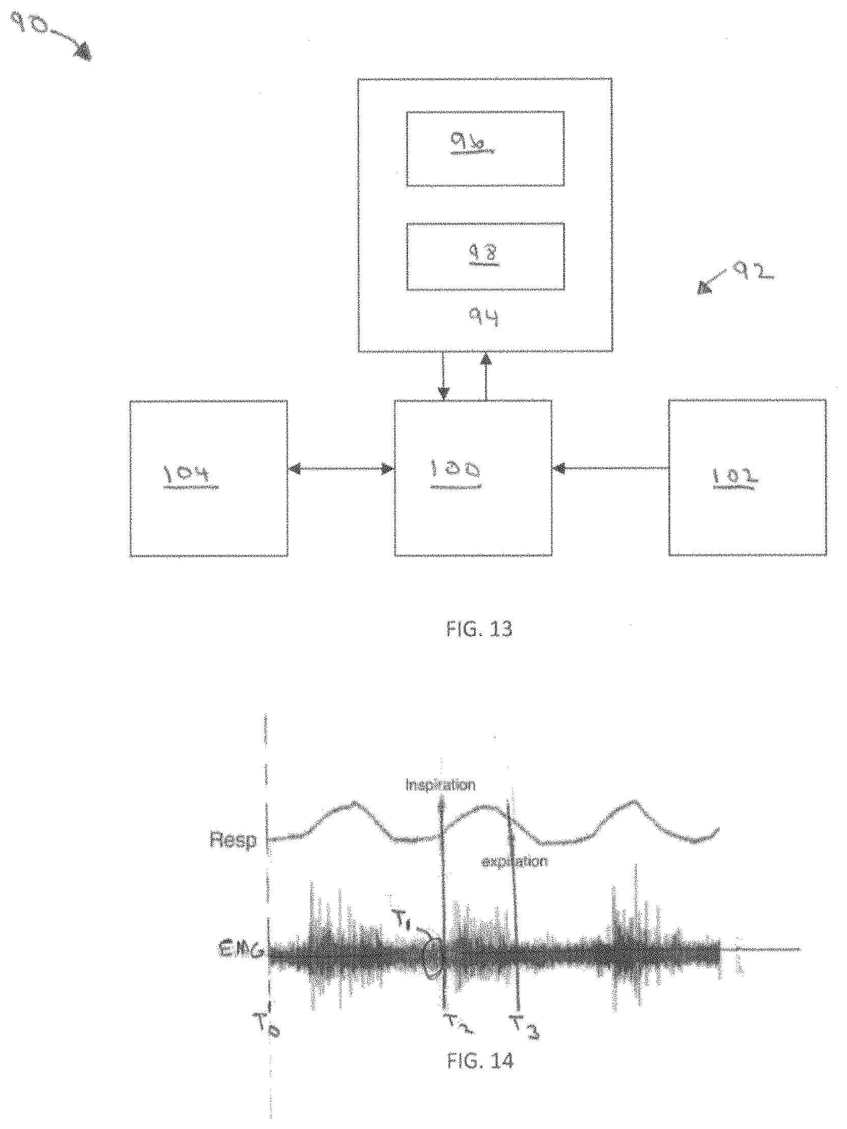 Patent US11771899 Figure 13 – System and method for treating obstructive sleep apnea