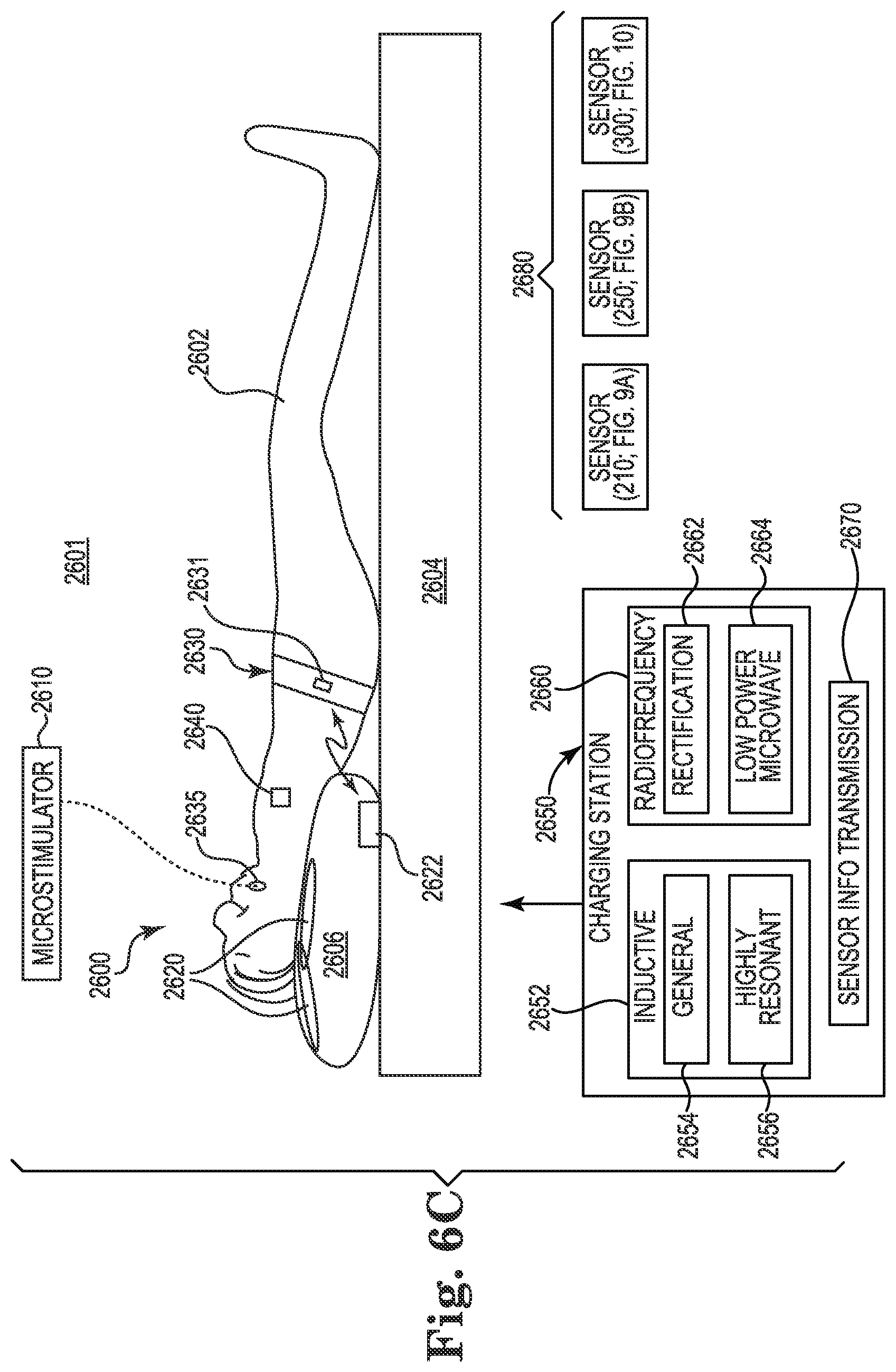 Patent US11771901 Figure 3 – Microstimulation sleep disordered breathing (SDB) therapy device