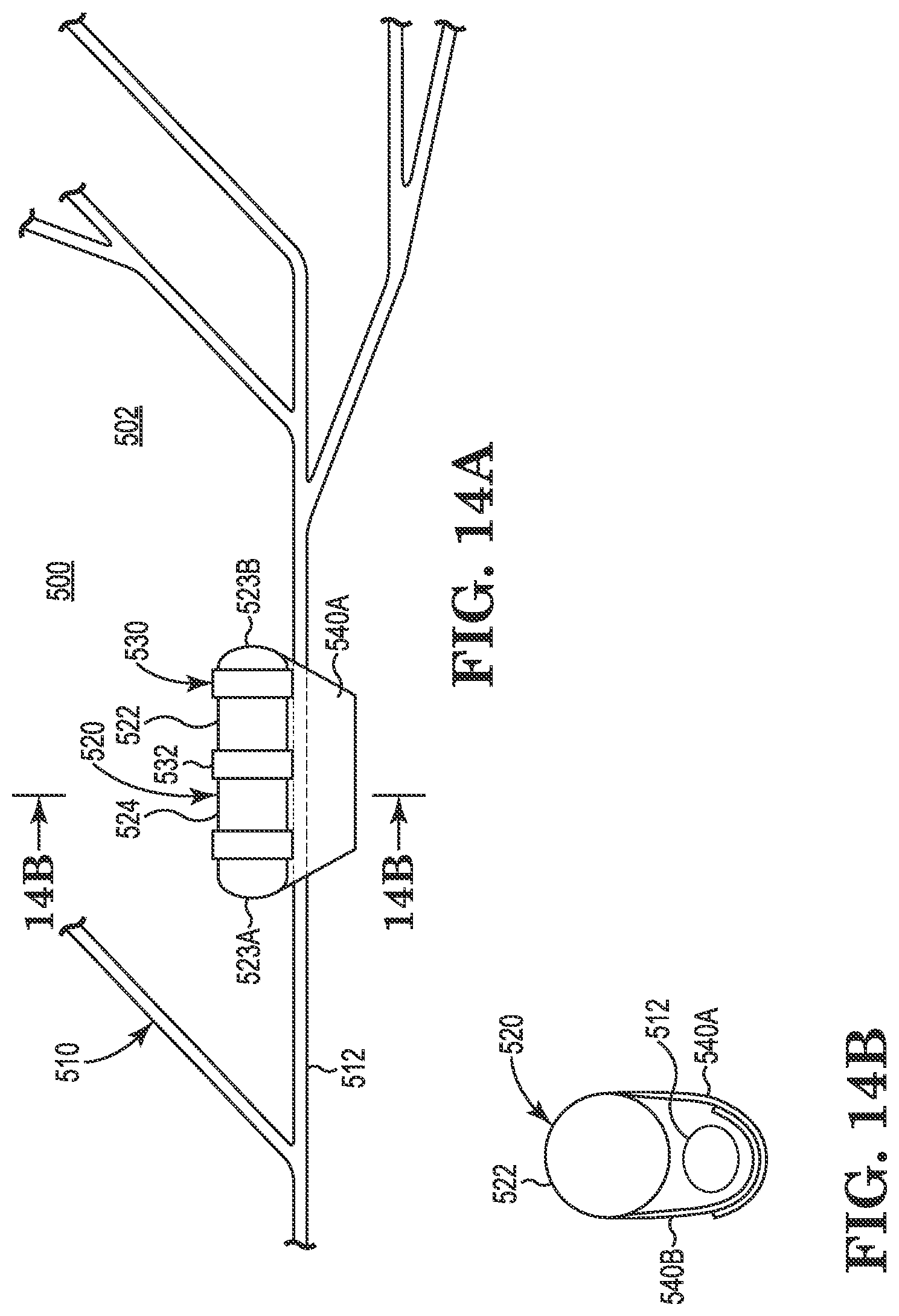 Patent US11771901 Figure 7 – Microstimulation sleep disordered breathing (SDB) therapy device