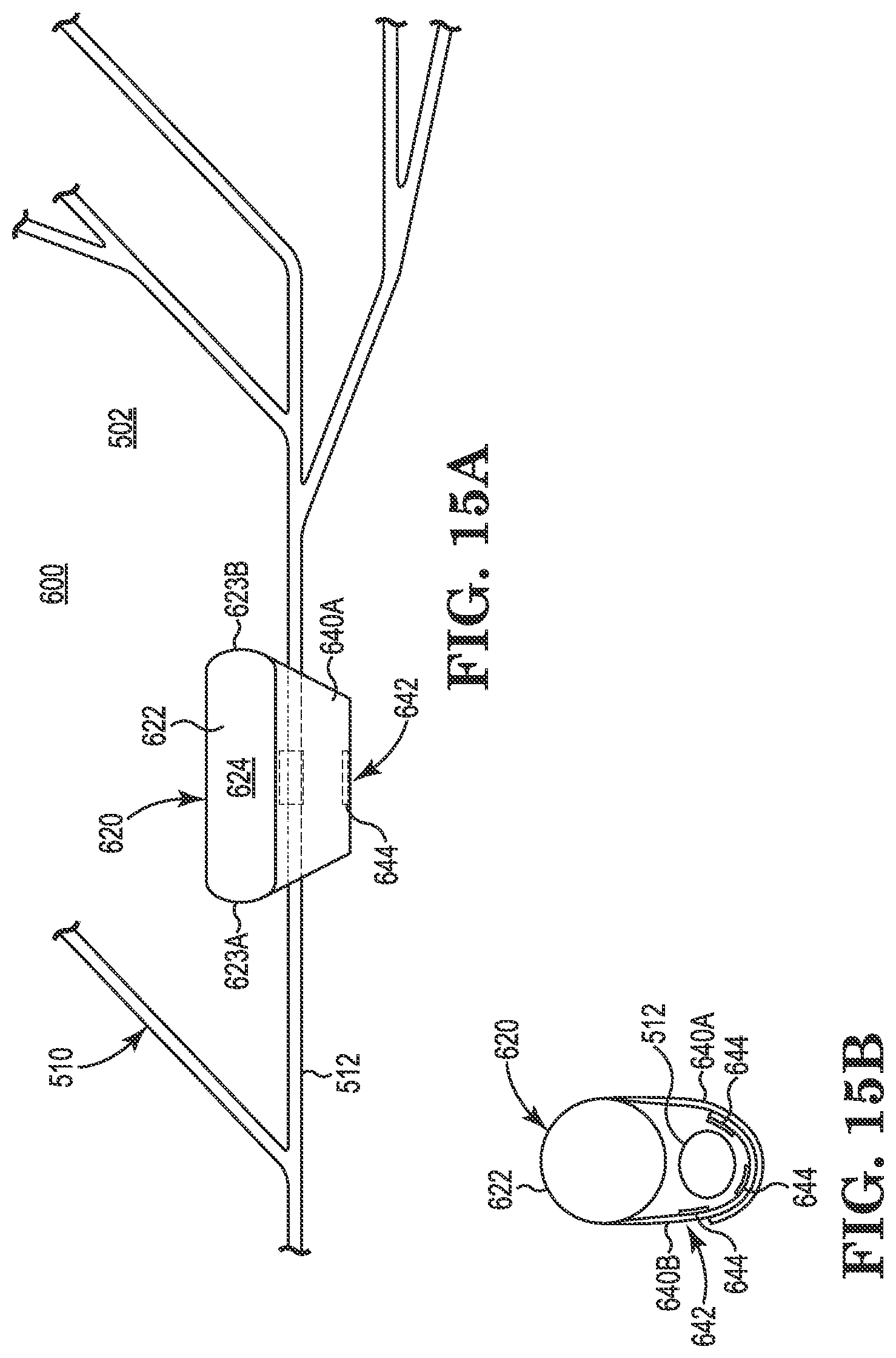 Patent US11771901 Figure 8 – Microstimulation sleep disordered breathing (SDB) therapy device