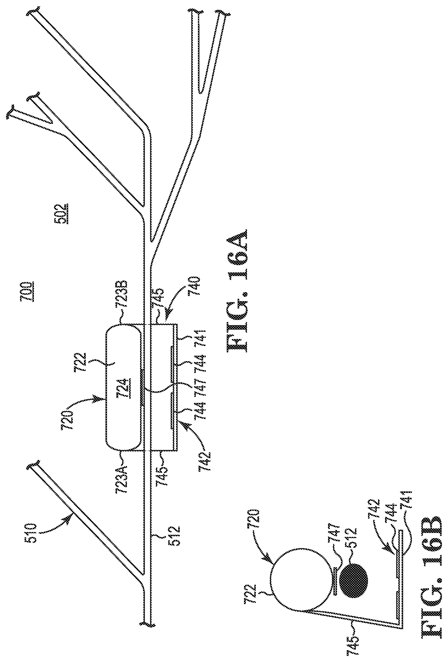 Patent US11771901 Figure 9 – Microstimulation sleep disordered breathing (SDB) therapy device