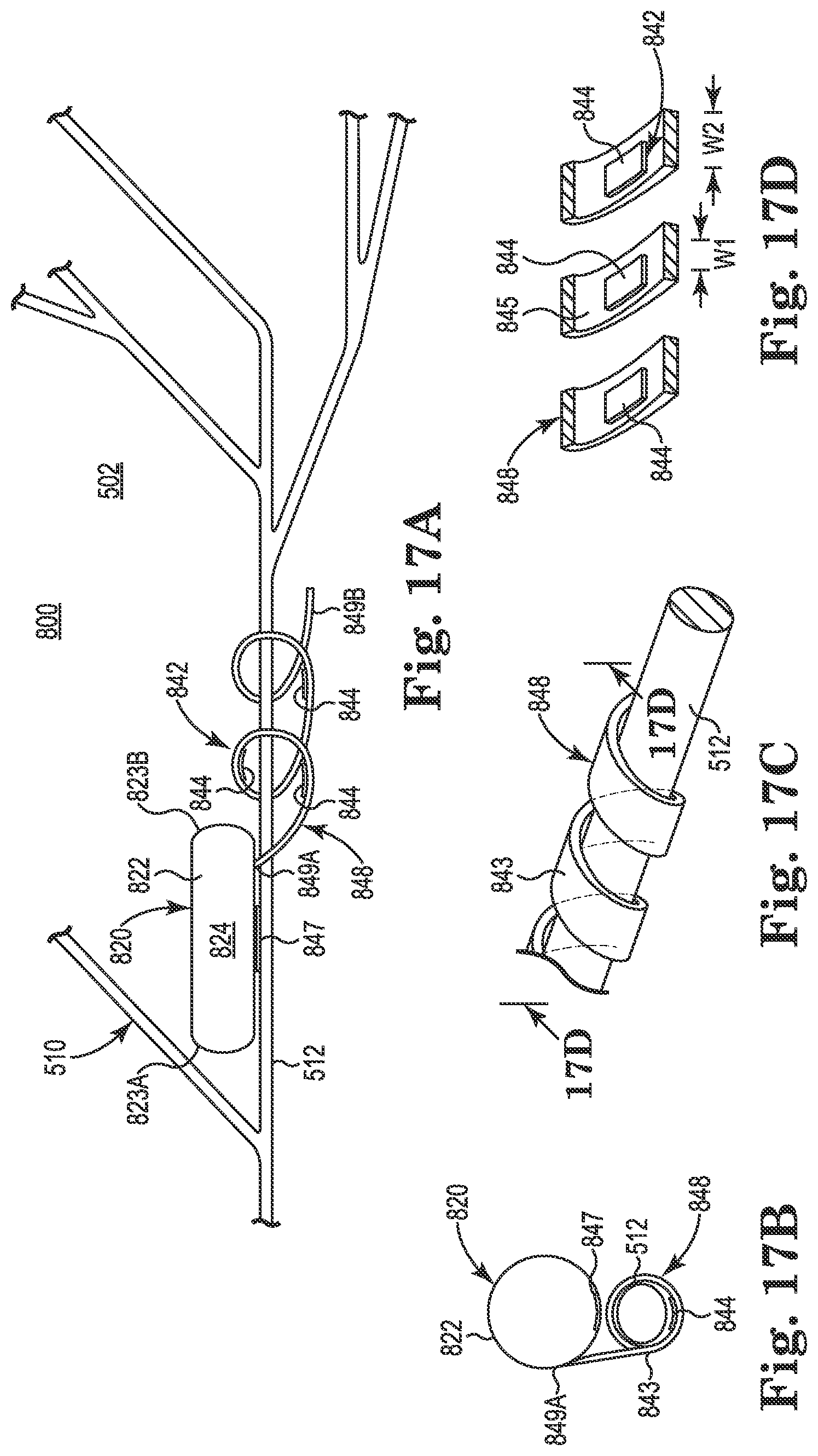 Patent US11771901 Figure 10 – Microstimulation sleep disordered breathing (SDB) therapy device