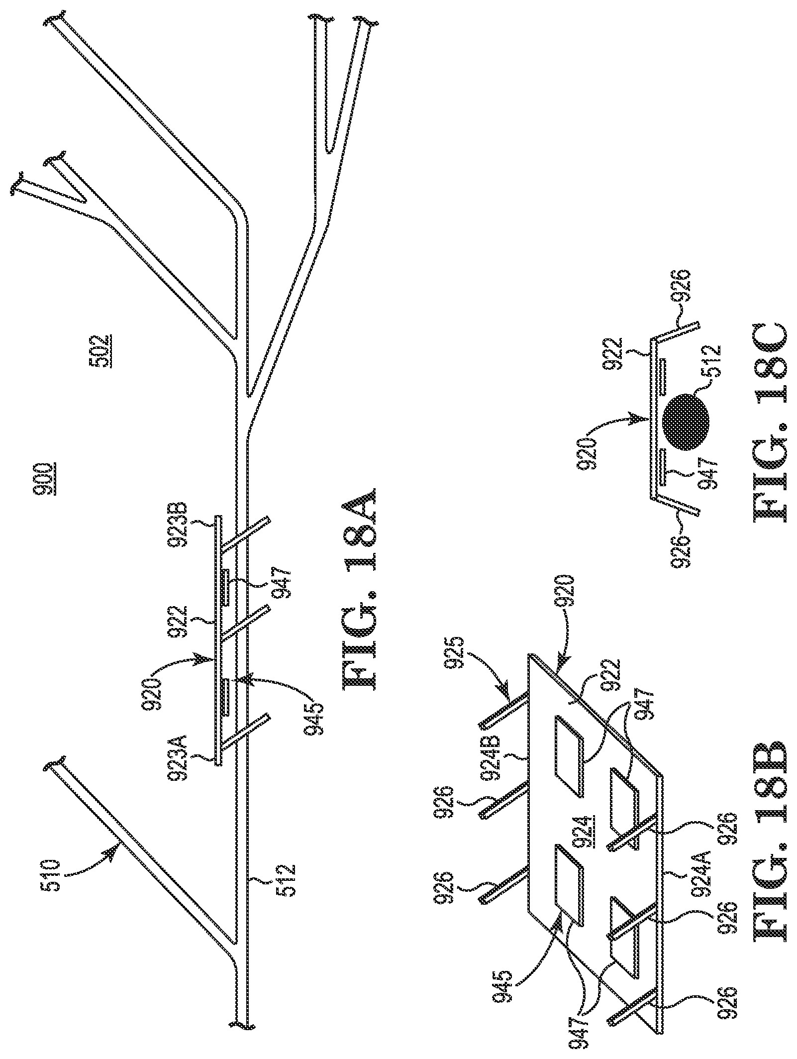 Patent US11771901 Figure 11 – Microstimulation sleep disordered breathing (SDB) therapy device