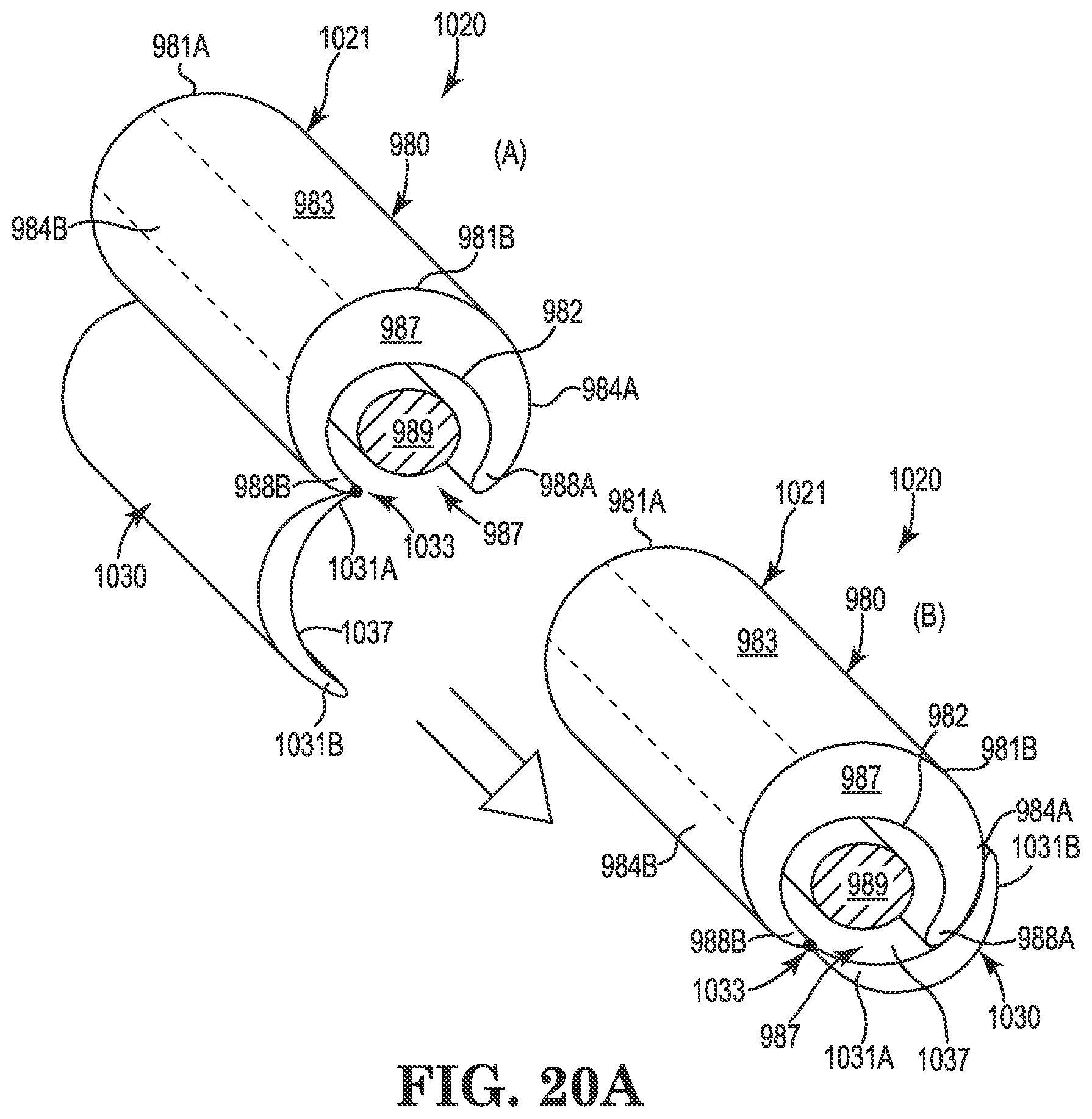 Patent US11771901 Figure 13 – Microstimulation sleep disordered breathing (SDB) therapy device