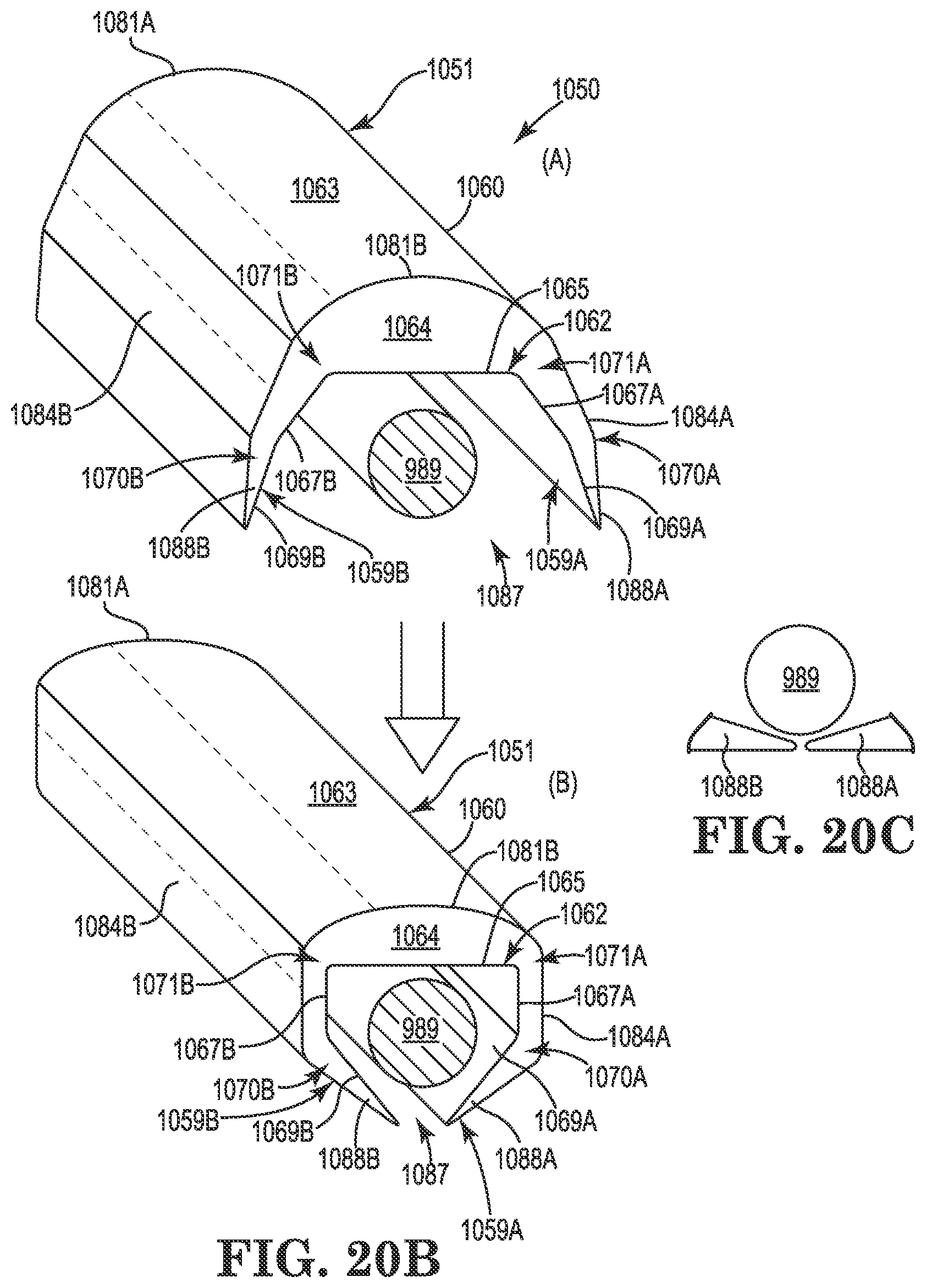Patent US11771901 Figure 14 – Microstimulation sleep disordered breathing (SDB) therapy device