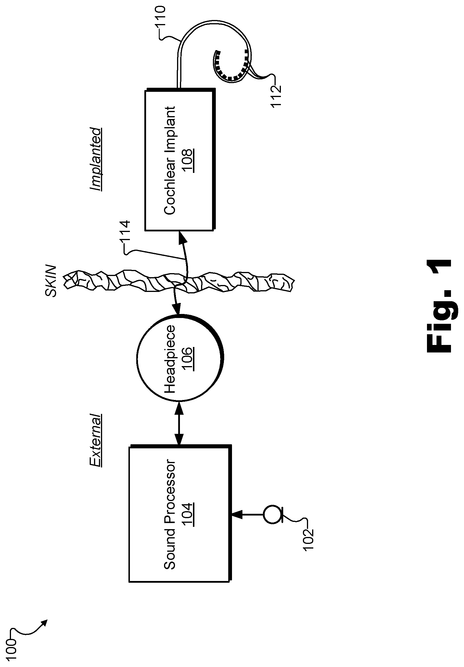 Patent US11771903 Figure 1 – Apparatuses and methods for managing stimulation parameters for an implant