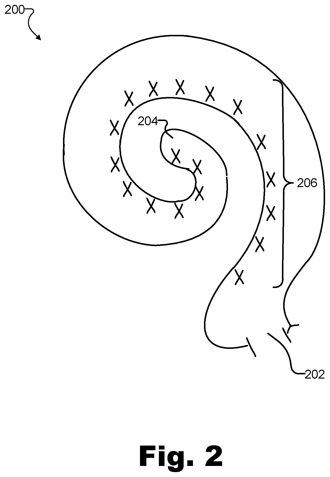 Patent US11771903 Figure 2 – Apparatuses and methods for managing stimulation parameters for an implant
