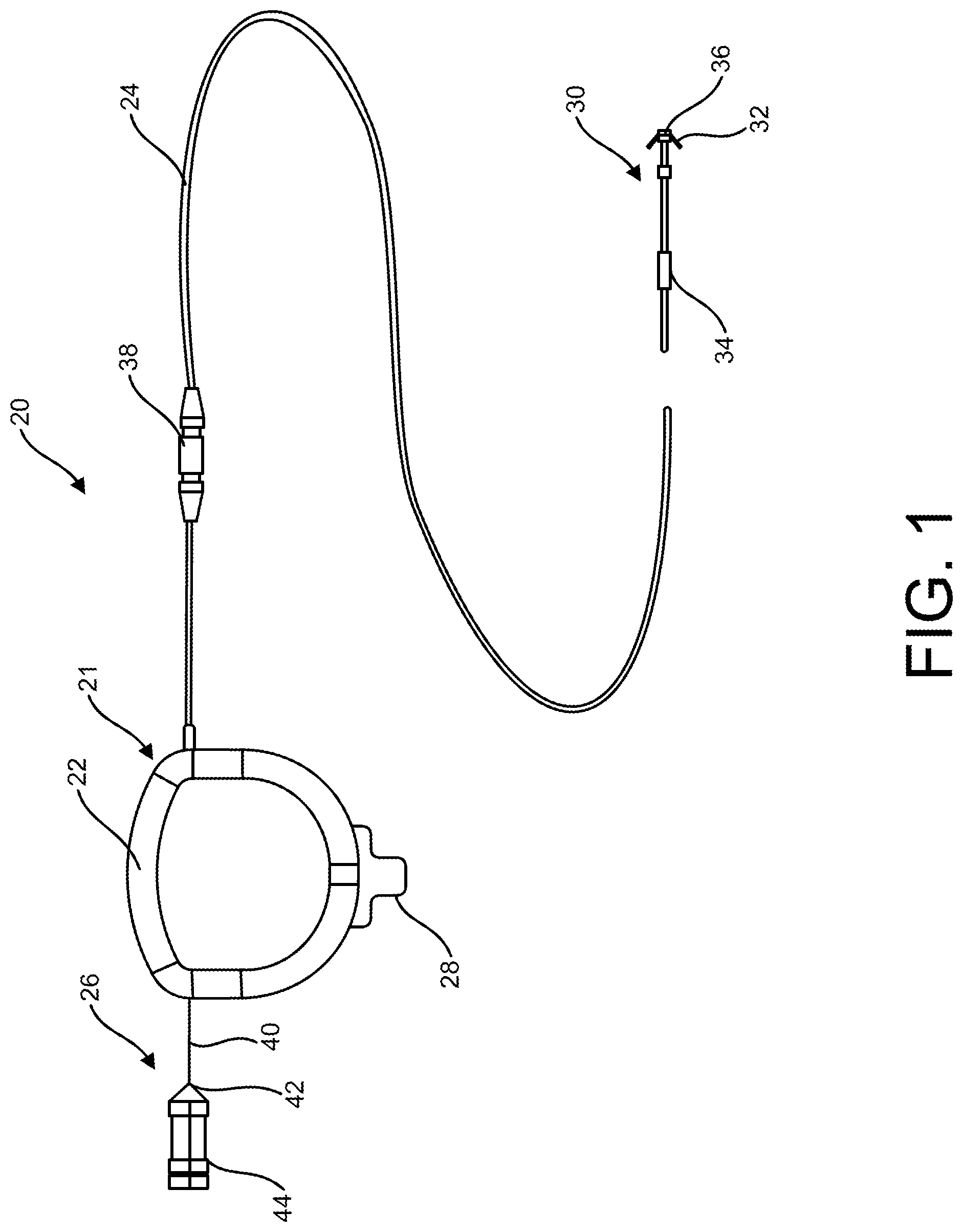 Patent US11771906 Figure 1 – Temporary pacemaker