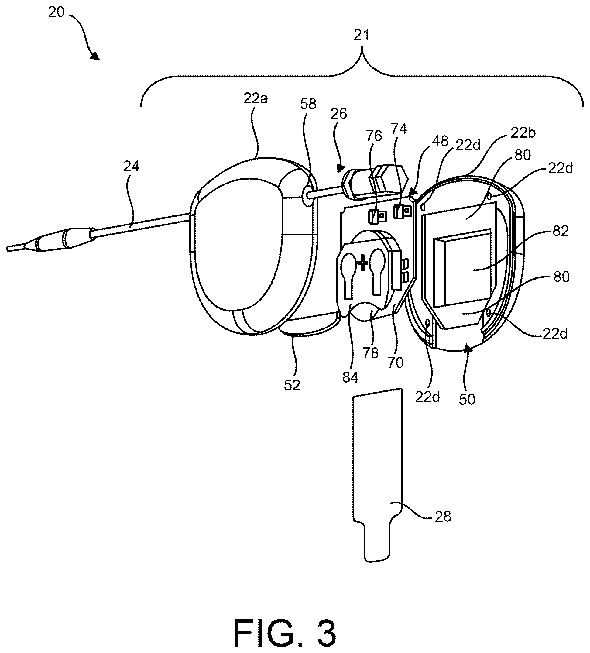 Patent US11771906 Figure 3 – Temporary pacemaker