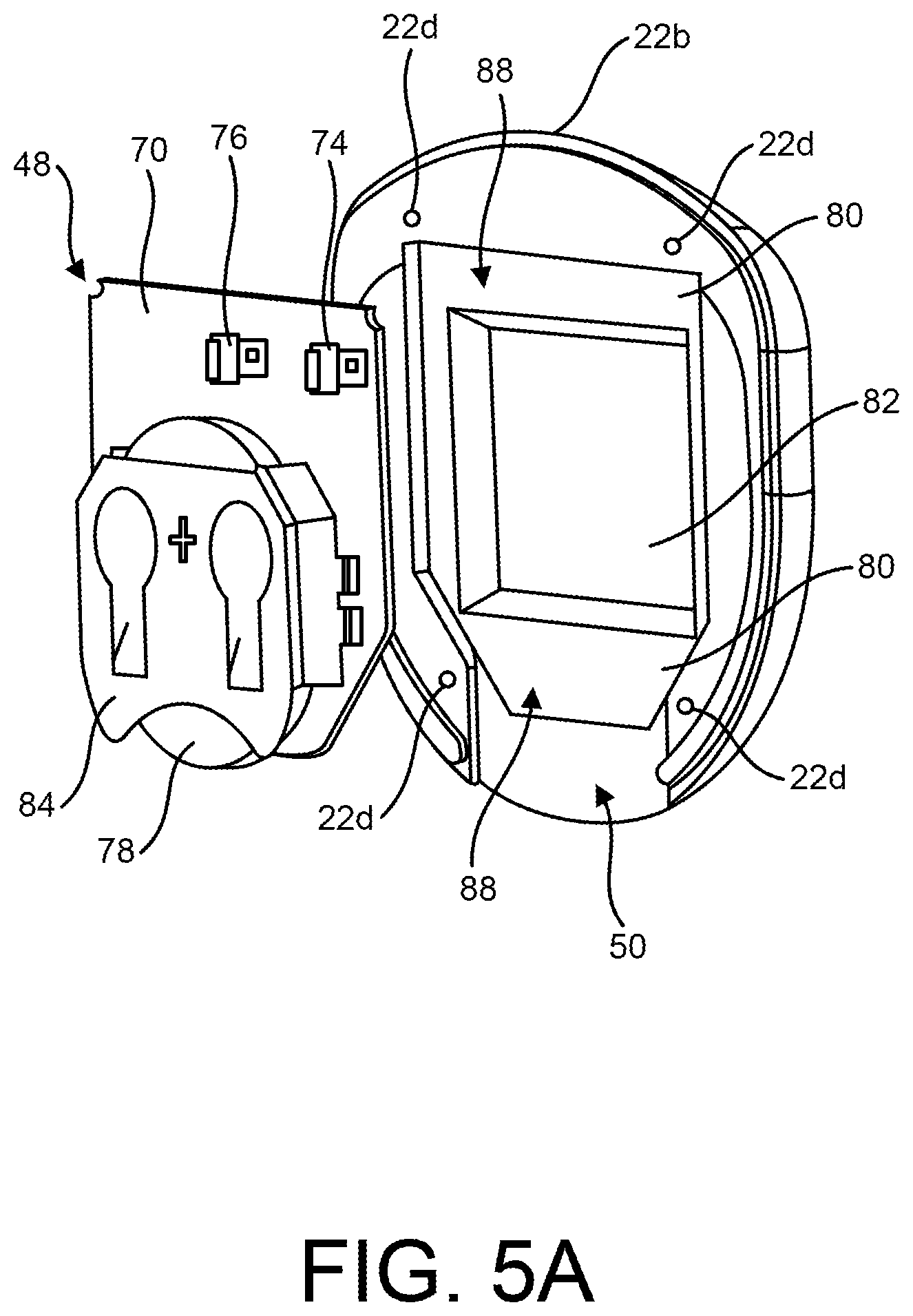 Patent US11771906 Figure 6 – Temporary pacemaker