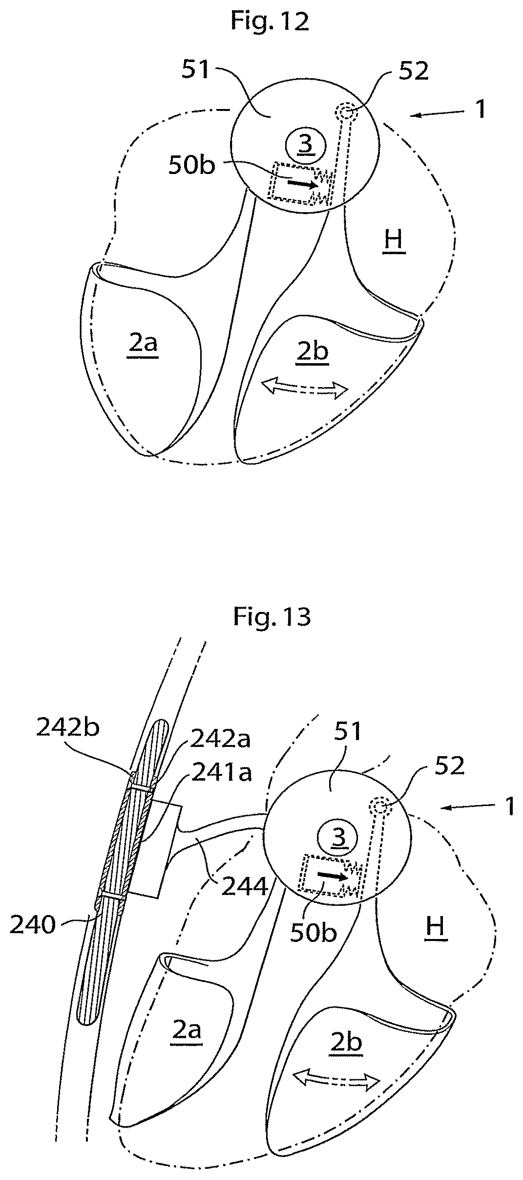 Patent US11771907 Figure 6 – Heart help device, system, and method