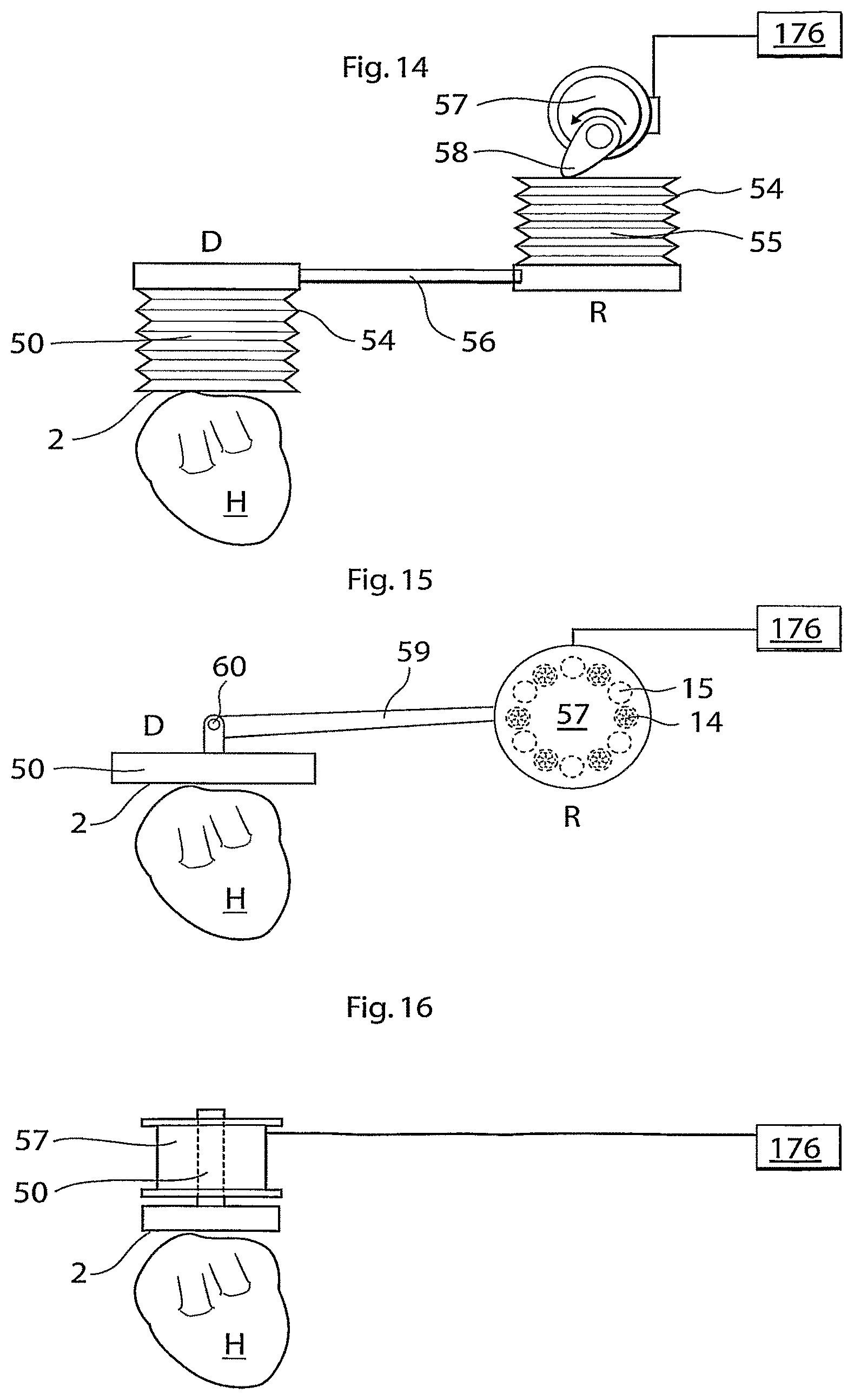 Patent US11771907 Figure 7 – Heart help device, system, and method