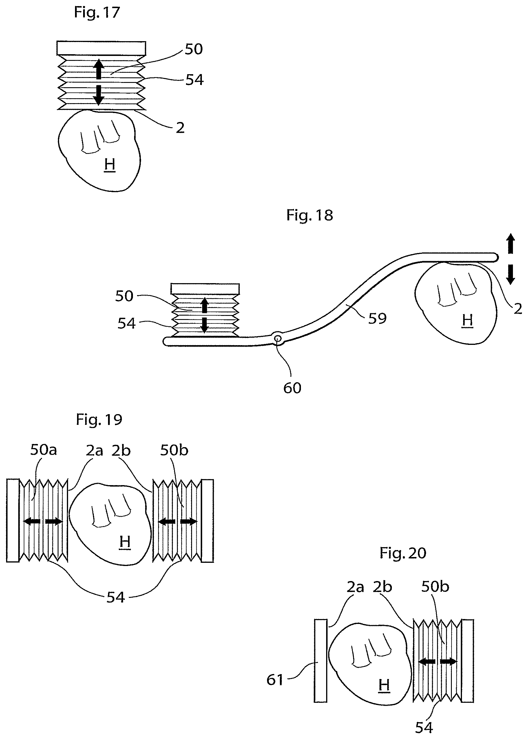 Patent US11771907 Figure 8 – Heart help device, system, and method