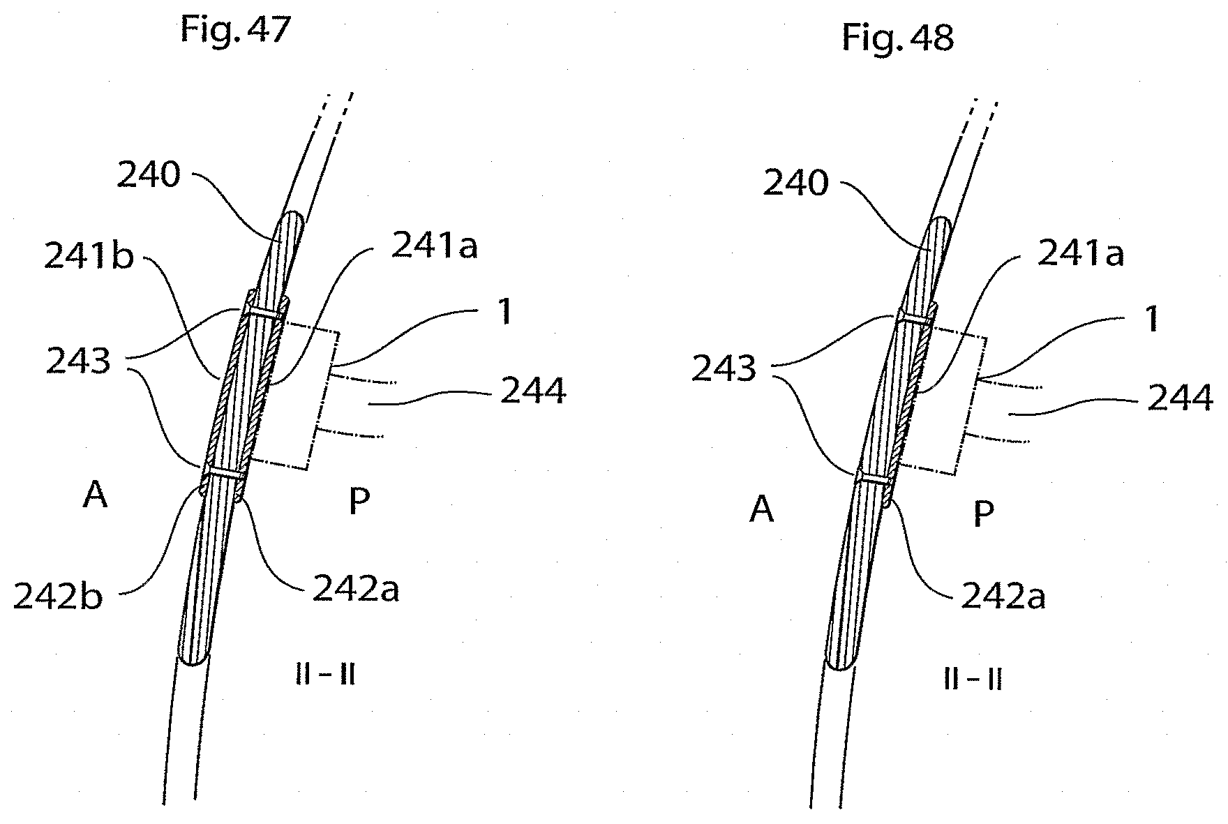 Patent US11771907 Figure 20 – Heart help device, system, and method
