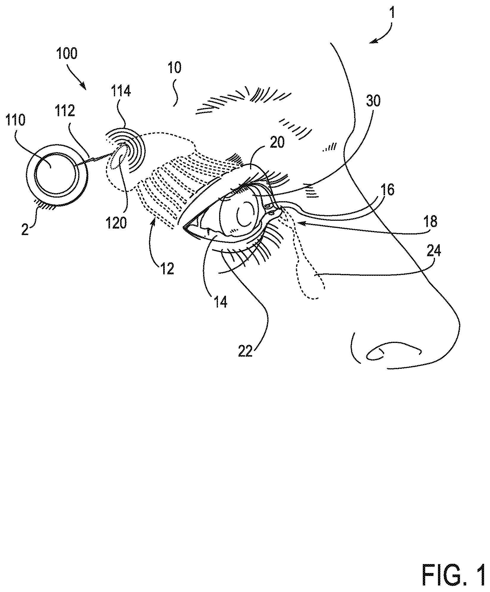 Patent US11771908 Figure 1 – Systems and methods for treatment of dry eye