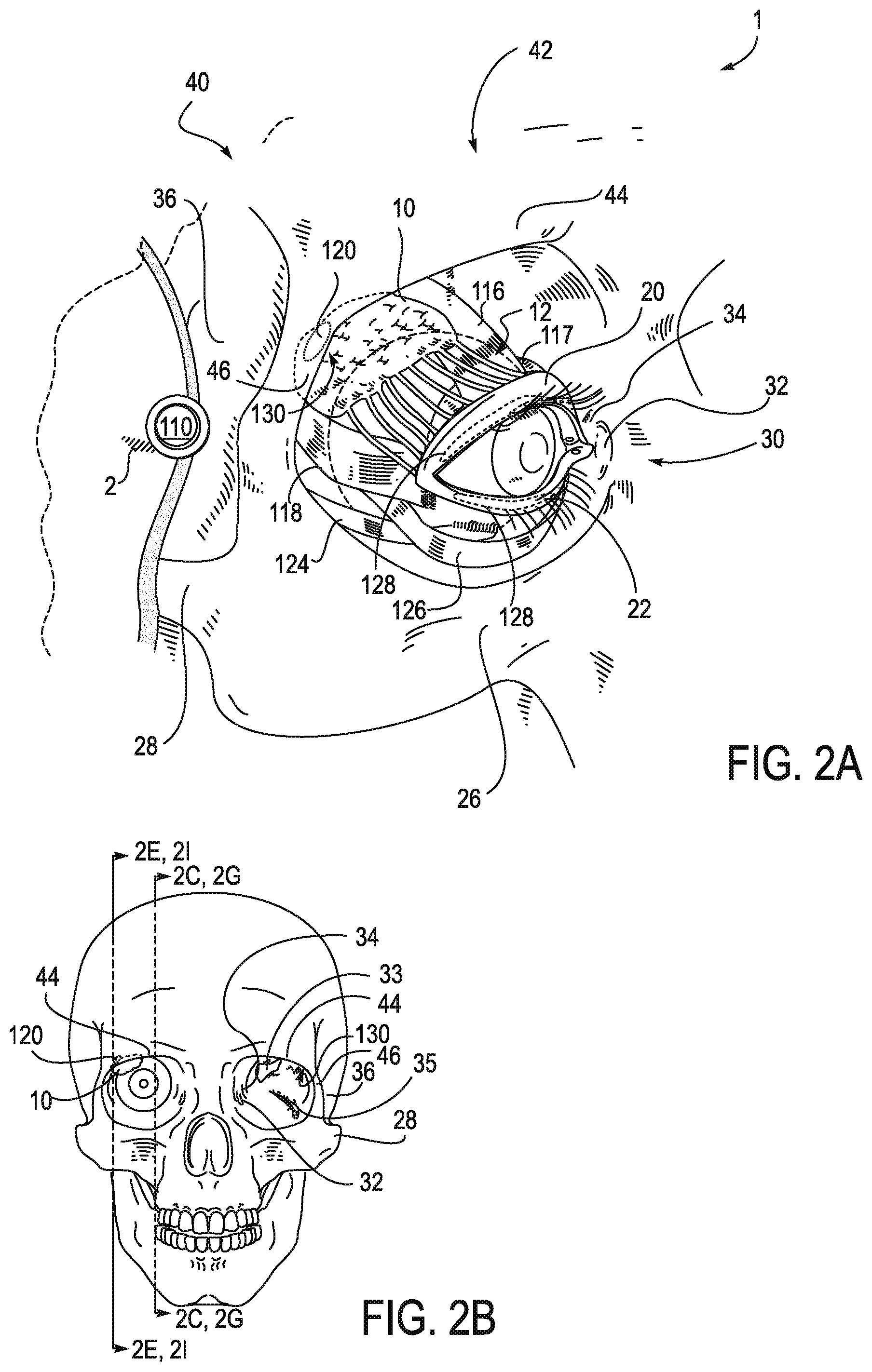 Patent US11771908 Figure 2 – Systems and methods for treatment of dry eye