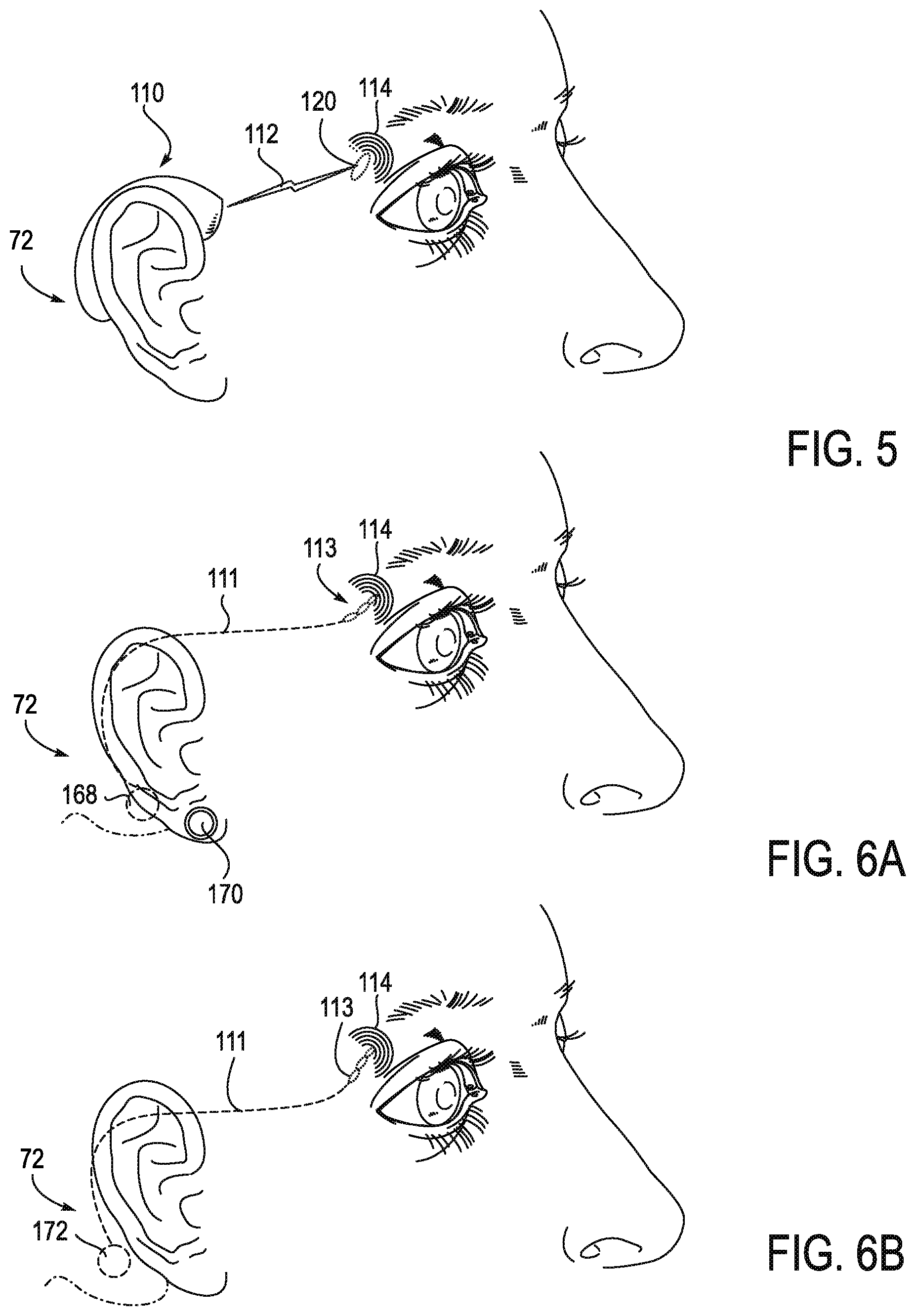 Patent US11771908 Figure 8 – Systems and methods for treatment of dry eye