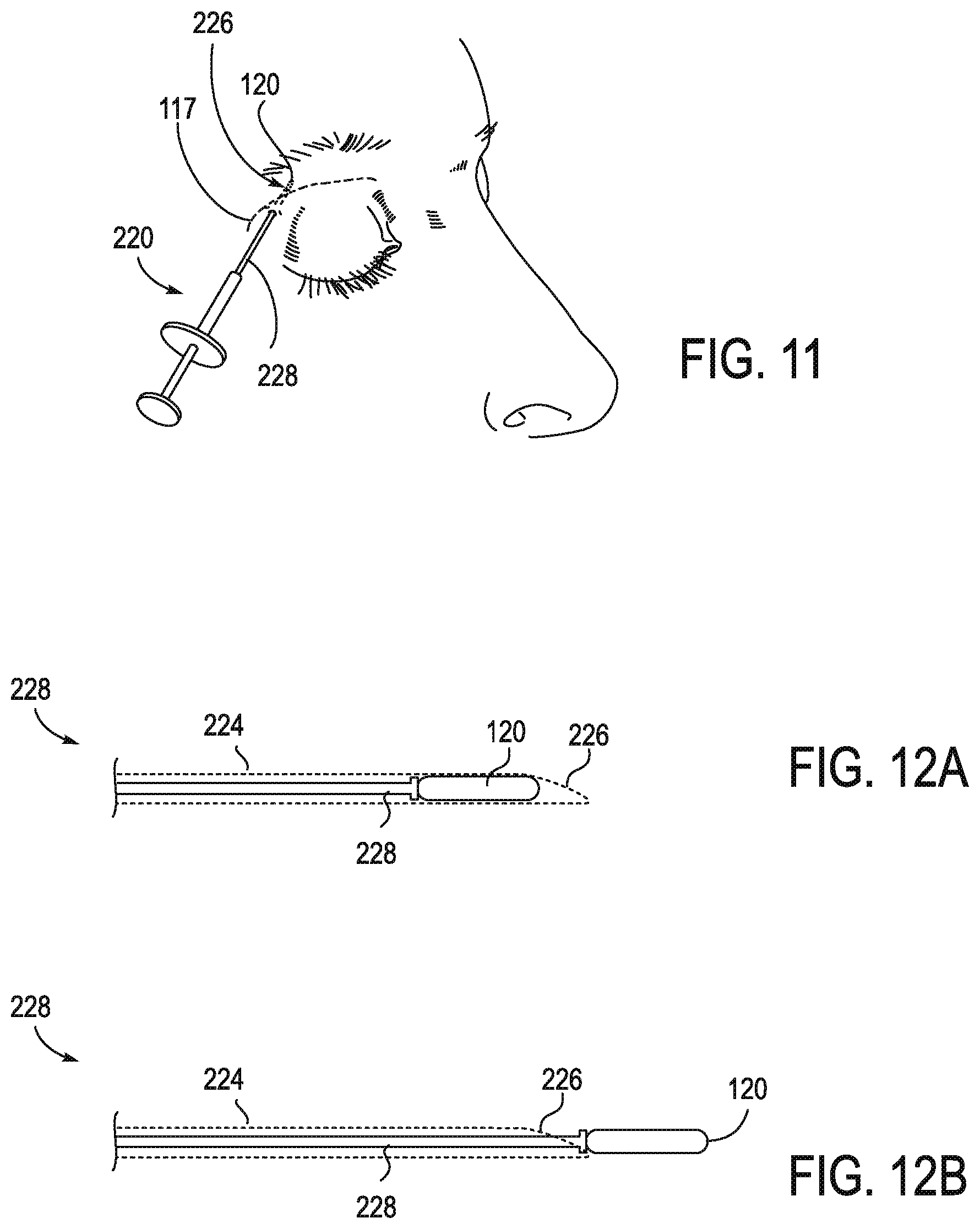 Patent US11771908 Figure 14 – Systems and methods for treatment of dry eye