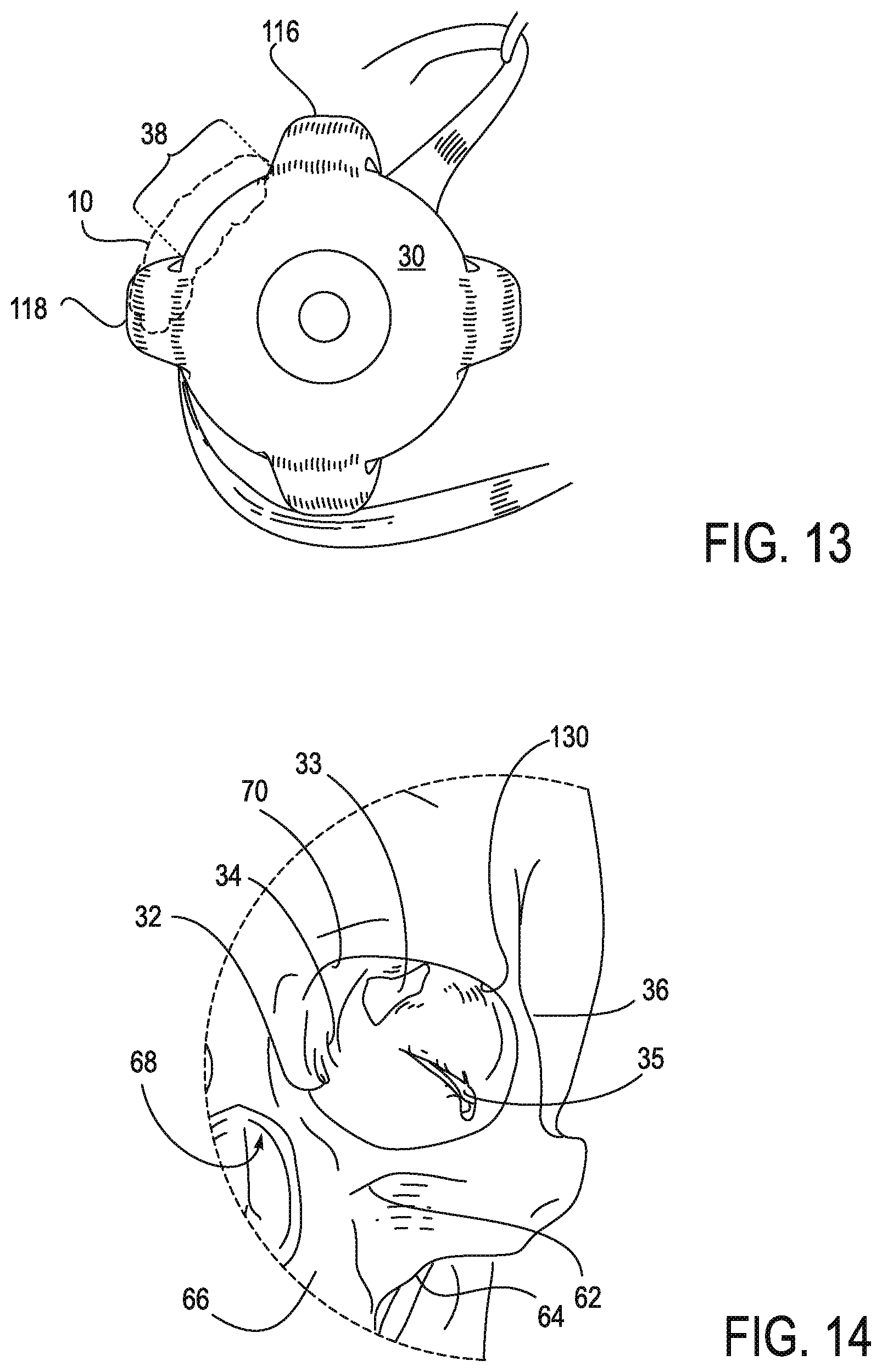 Patent US11771908 Figure 15 – Systems and methods for treatment of dry eye