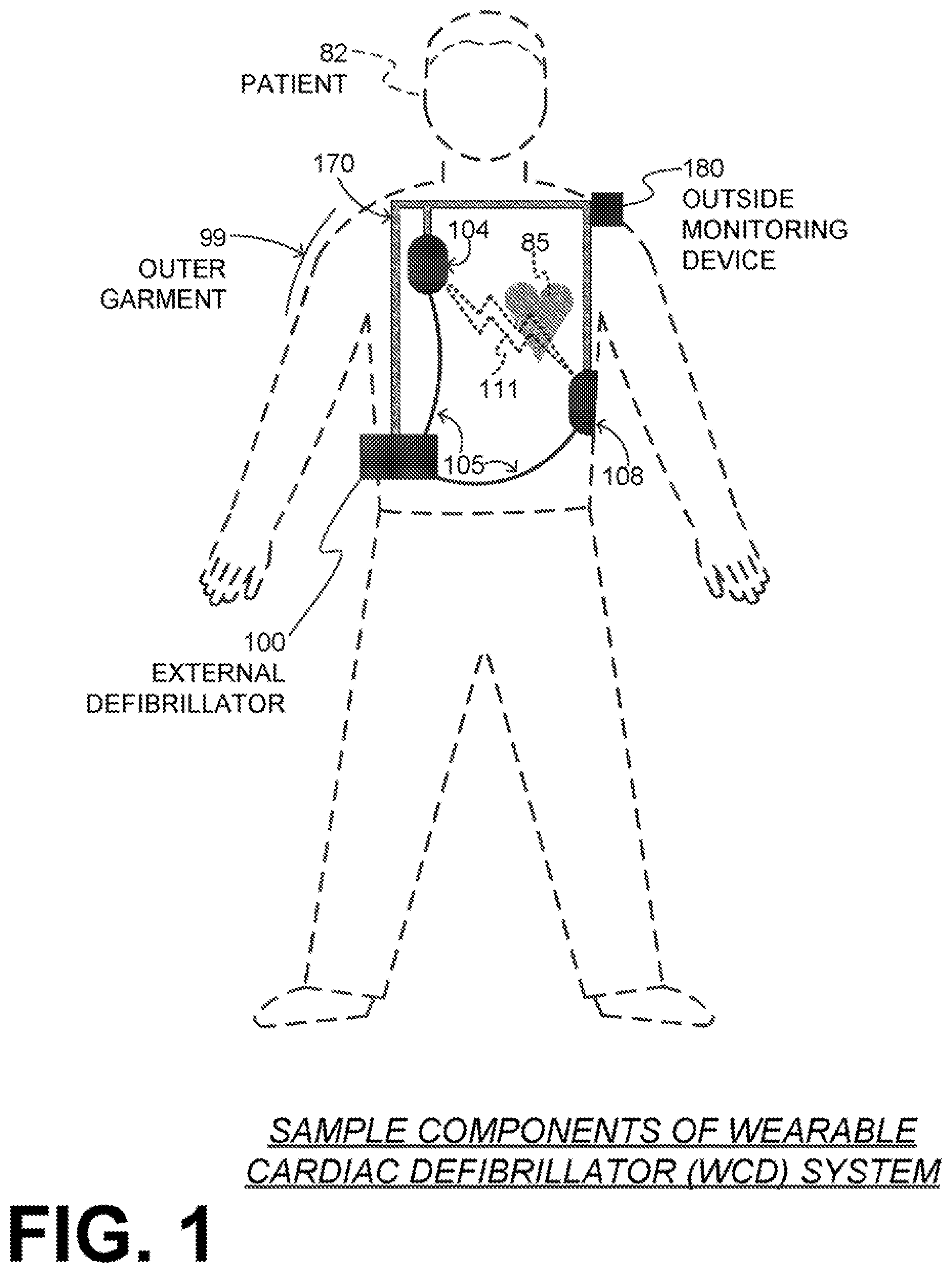Patent US11771909 Figure 1 – Wearable cardiac defibrillator system authenticating person actuating cancel switch