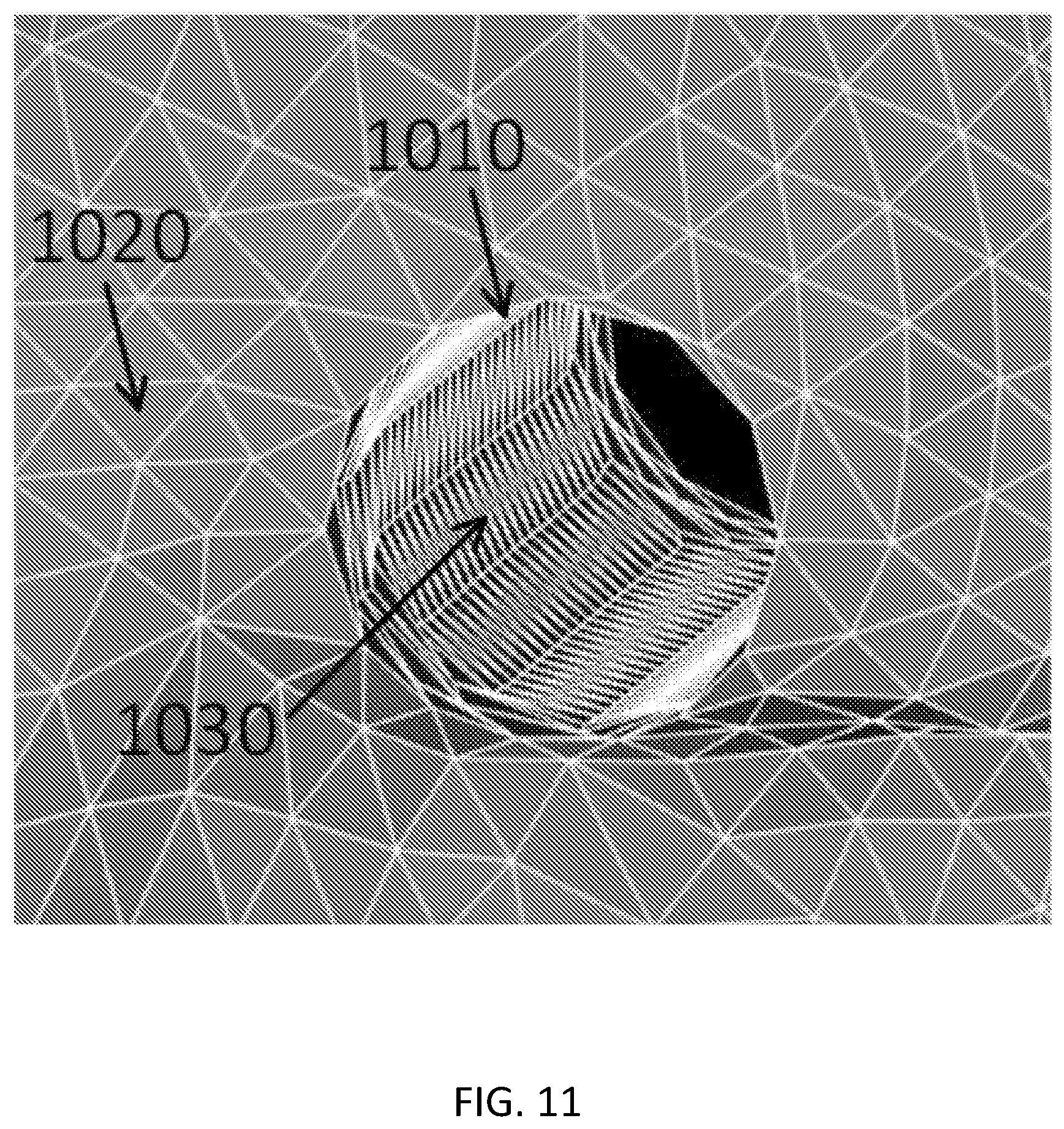 Patent US11771916 Figure 11 – Interstitial photodynamic therapy