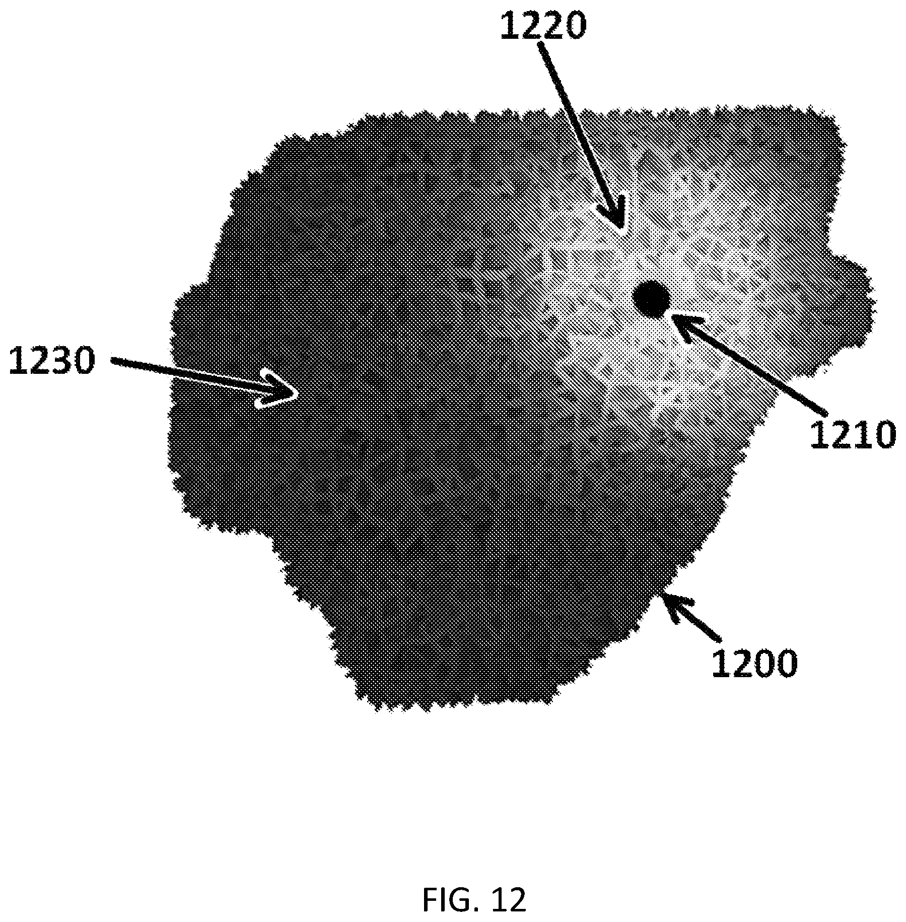 Patent US11771916 Figure 12 – Interstitial photodynamic therapy