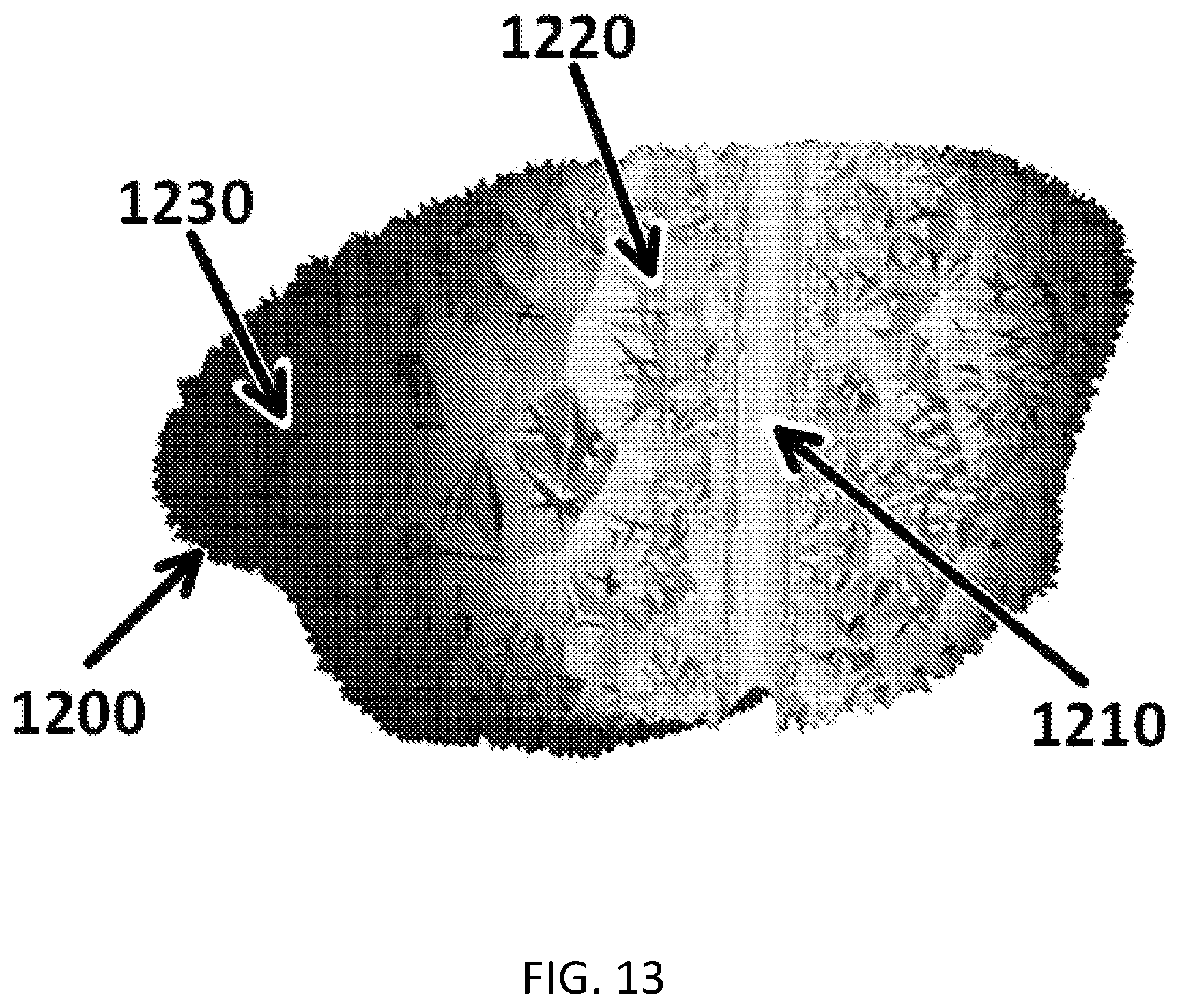 Patent US11771916 Figure 13 – Interstitial photodynamic therapy